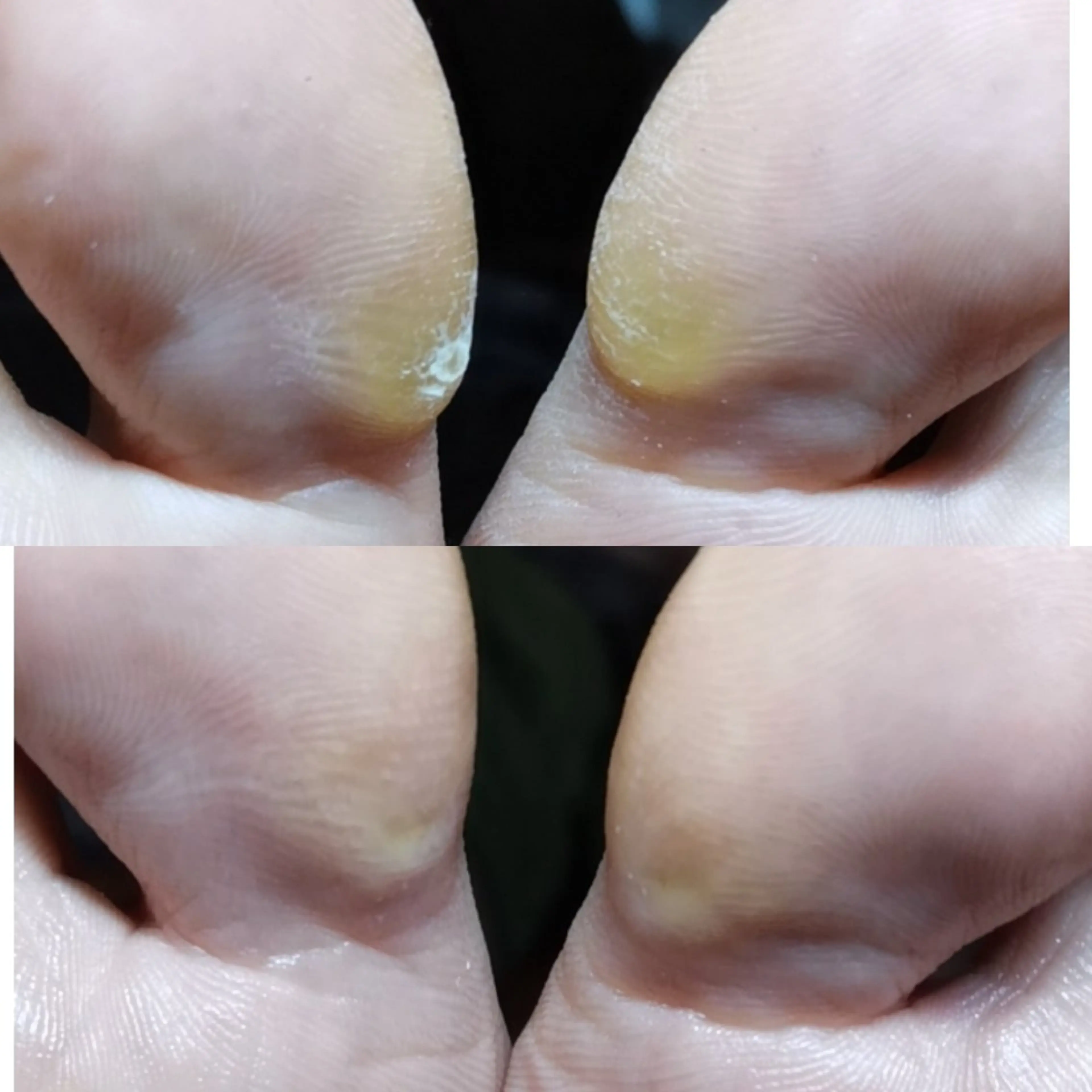 ネイル ROUN' 齋藤のエステ・リラクイメージ