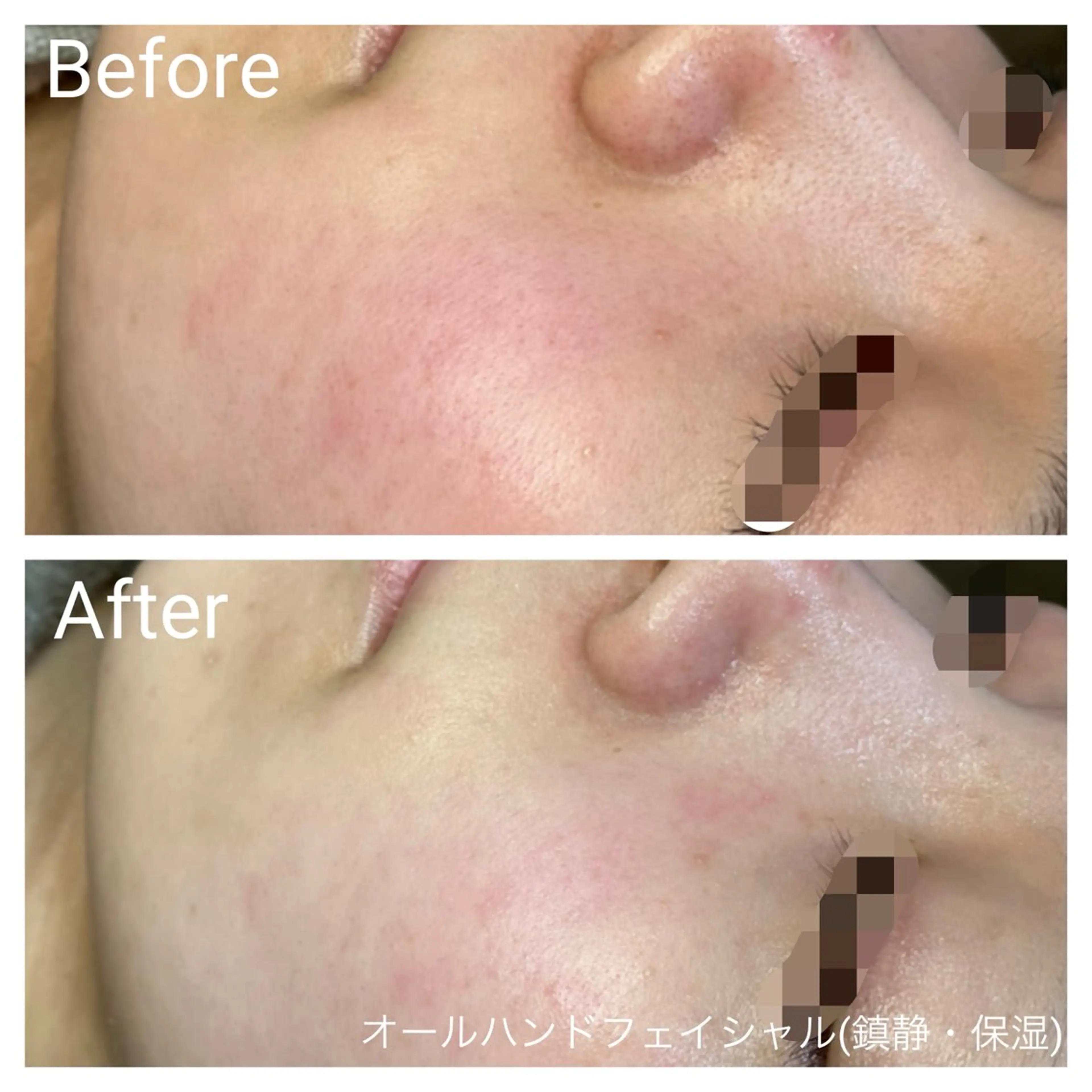 エステ リラク 深い肌悩み&早期脱毛 完了サロンのエステ・リラクイメージ