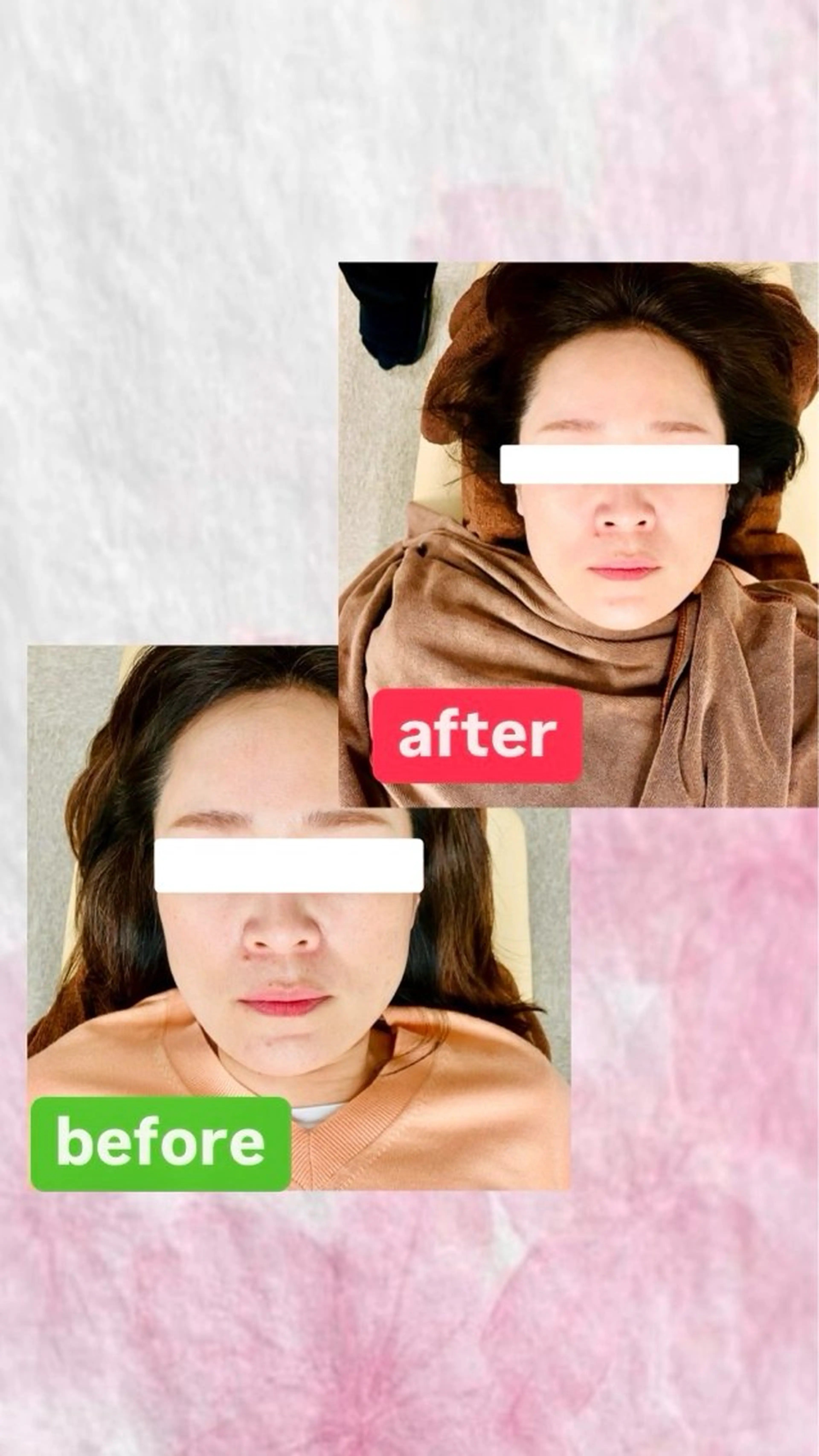 Arch整骨院所属・脳と関節から整える Arch整骨院のエステ・リラクイメージ