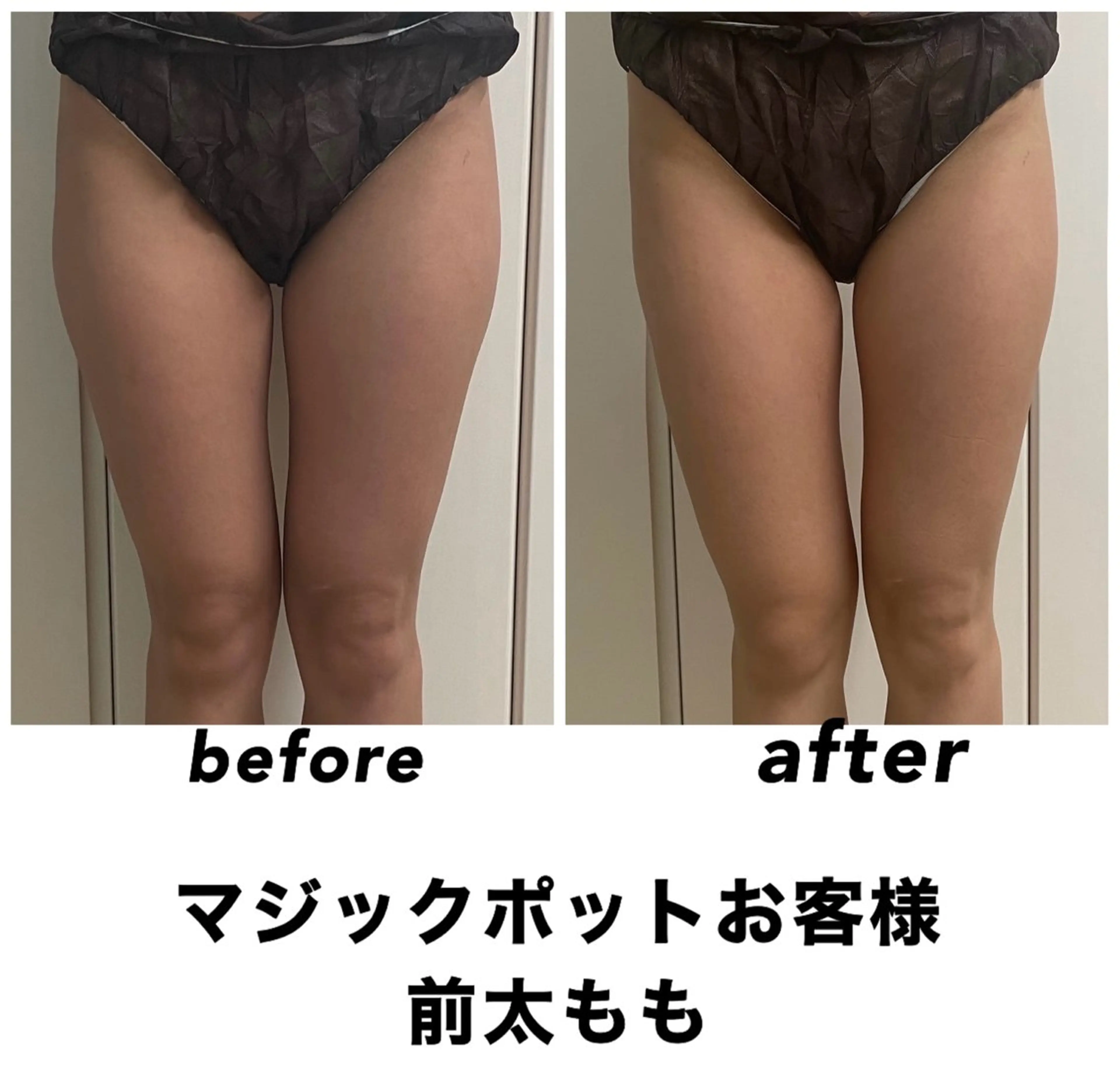 エステ リラク ネイル・エステサロン UILANIのネイルデザイン