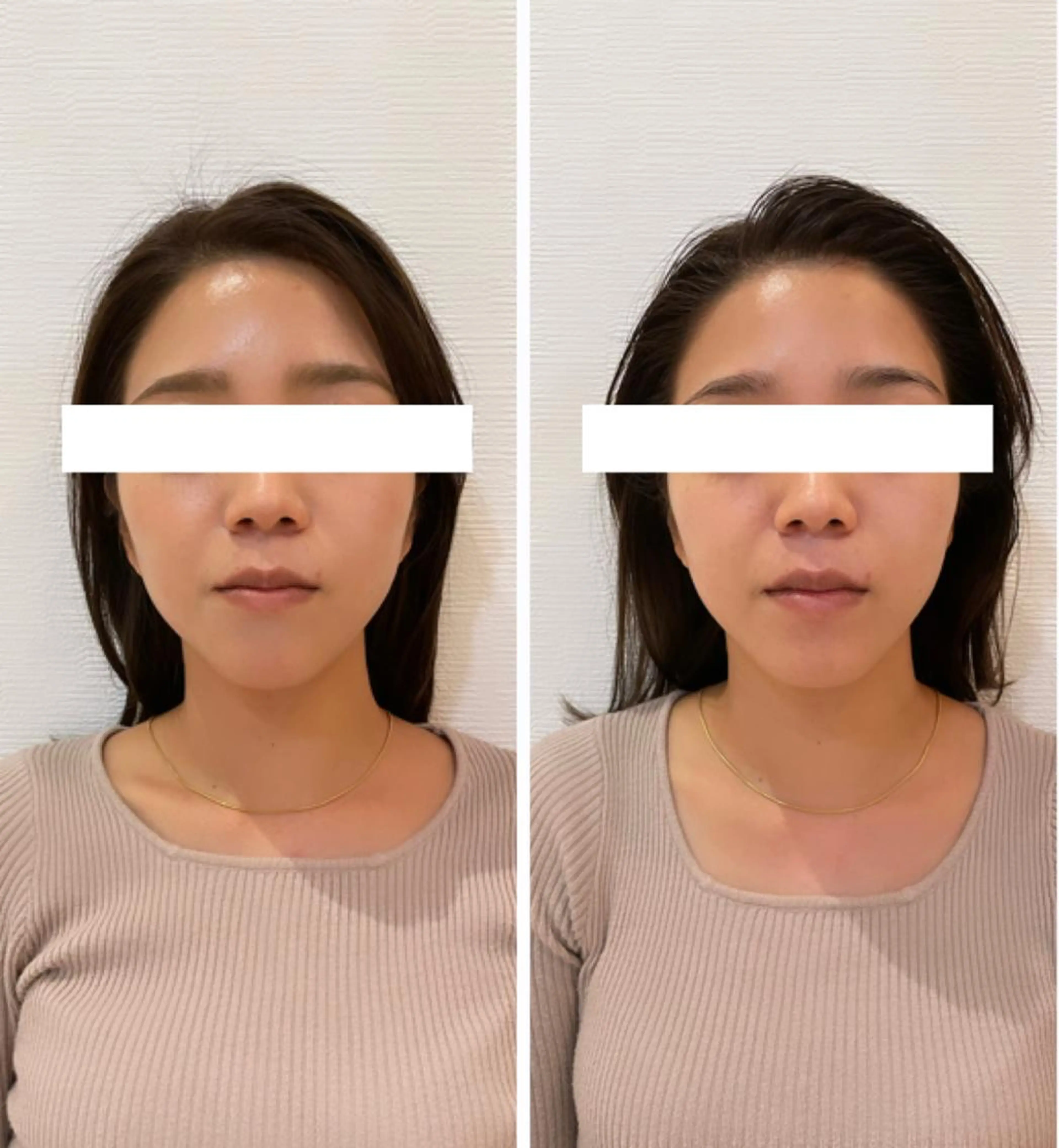 自律神経を整える フェイシャルエステのエステ・リラクイメージ