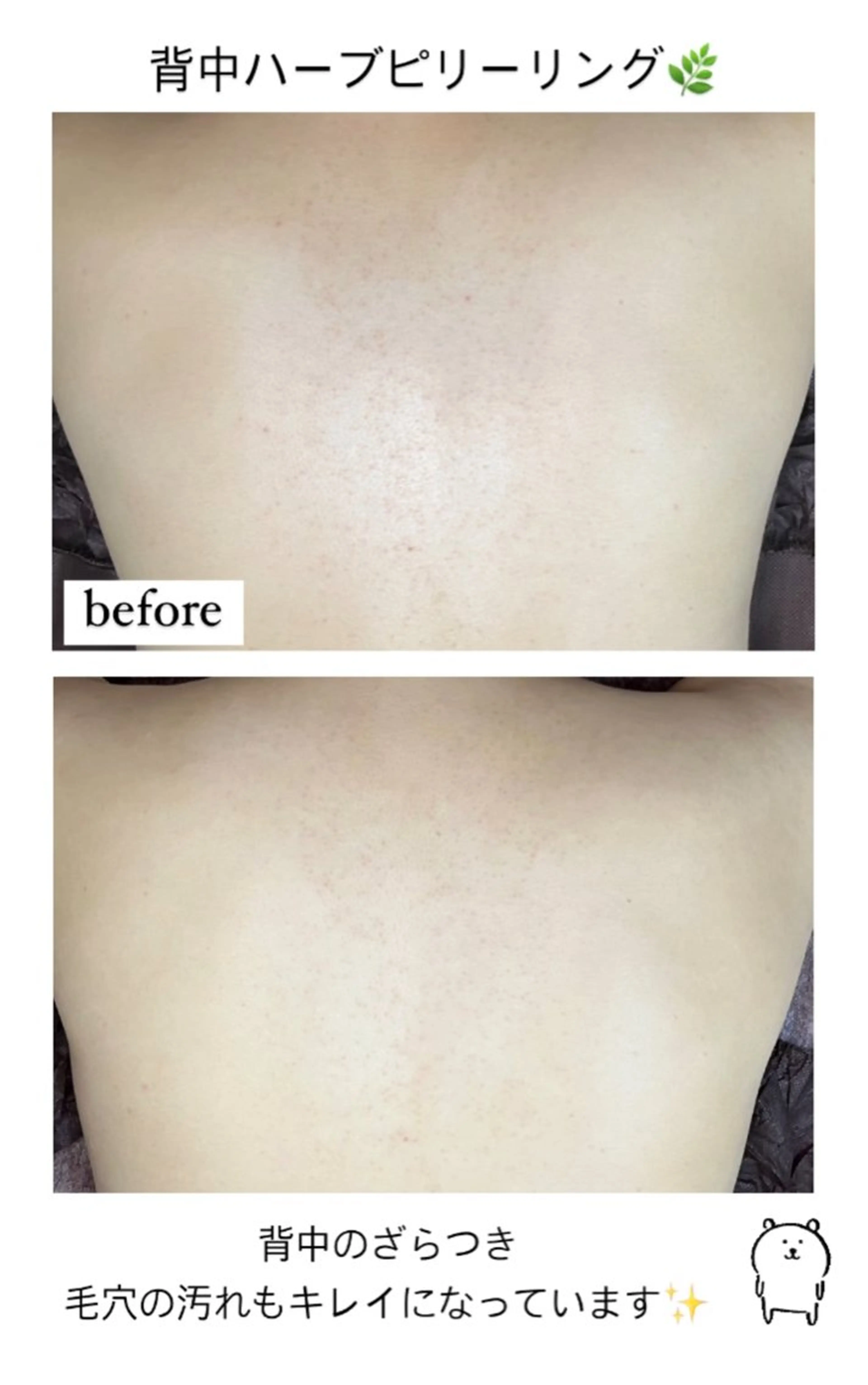 エステ ベラージュ【美背中・ 美尻・フェイシャル】のエステ・リラクイメージ