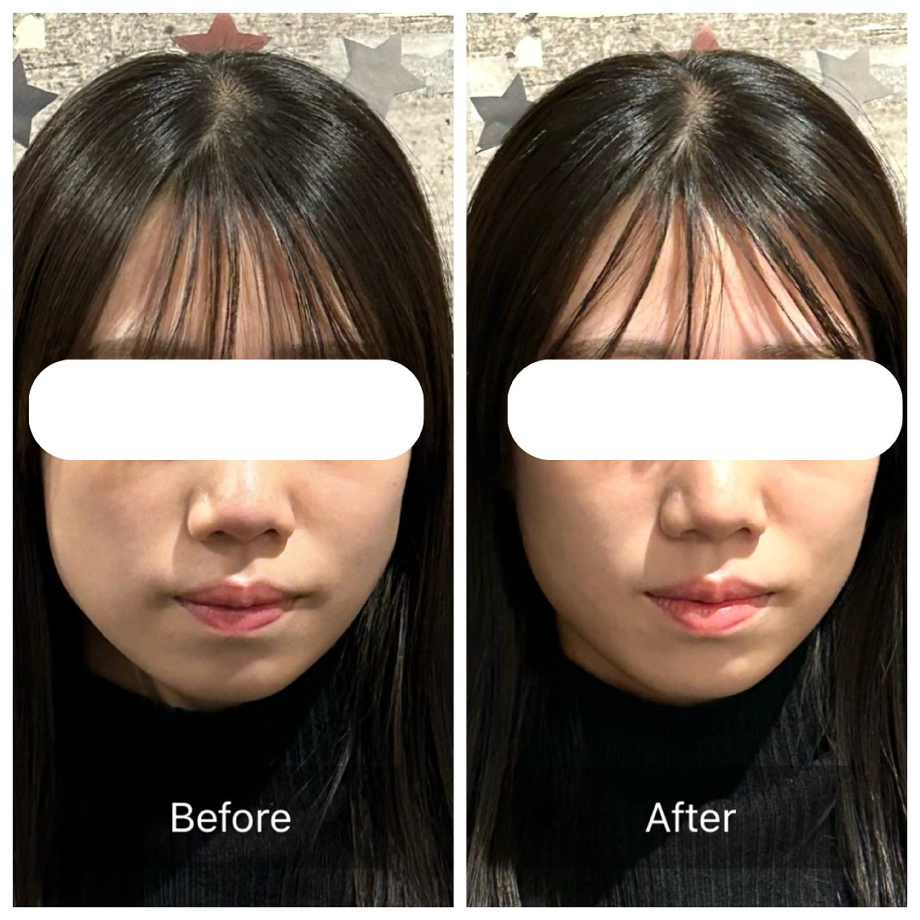 整体アンヨール 白石のエステ・リラクイメージ