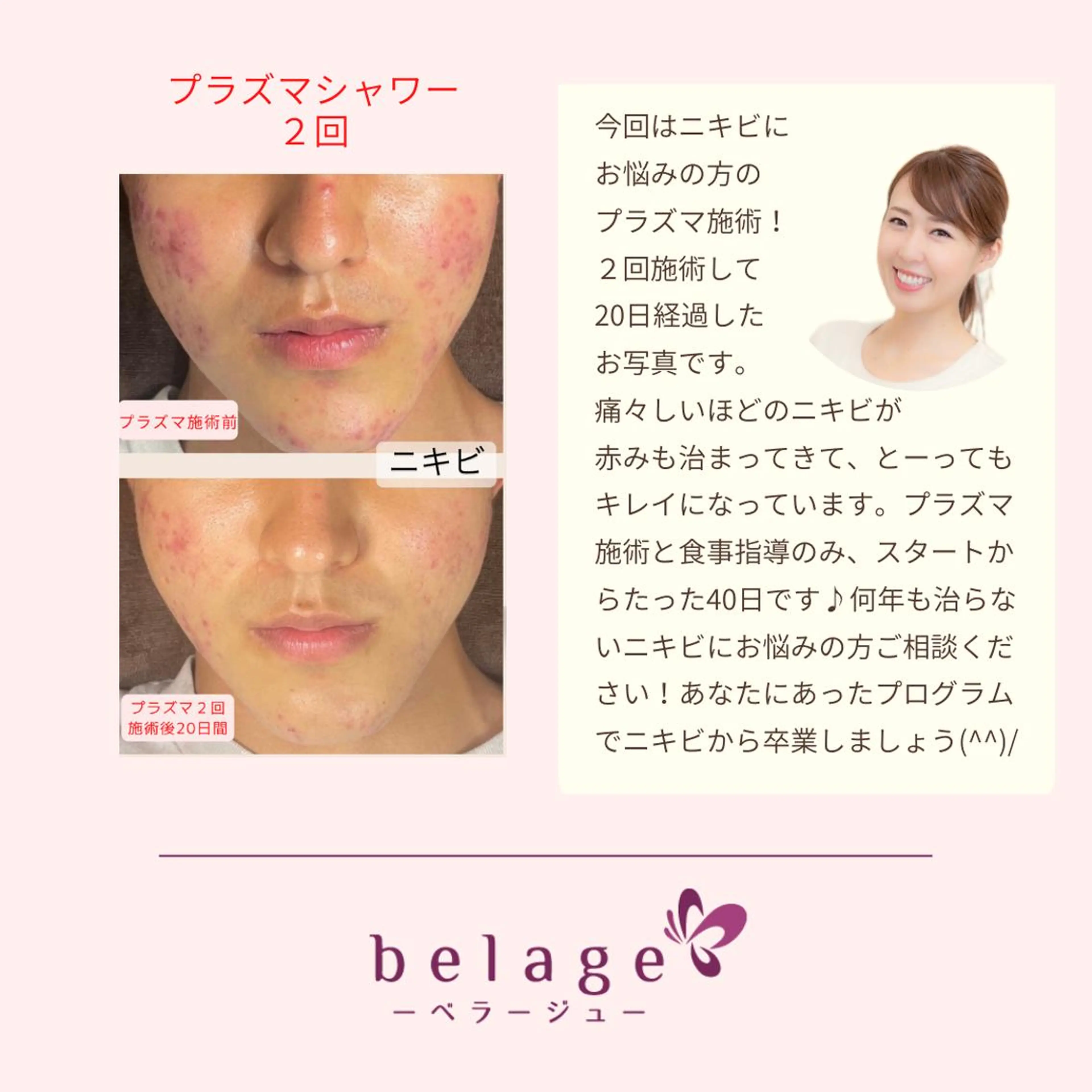 ベラージュ【美背中・ 美尻・フェイシャル】のエステ・リラクイメージ