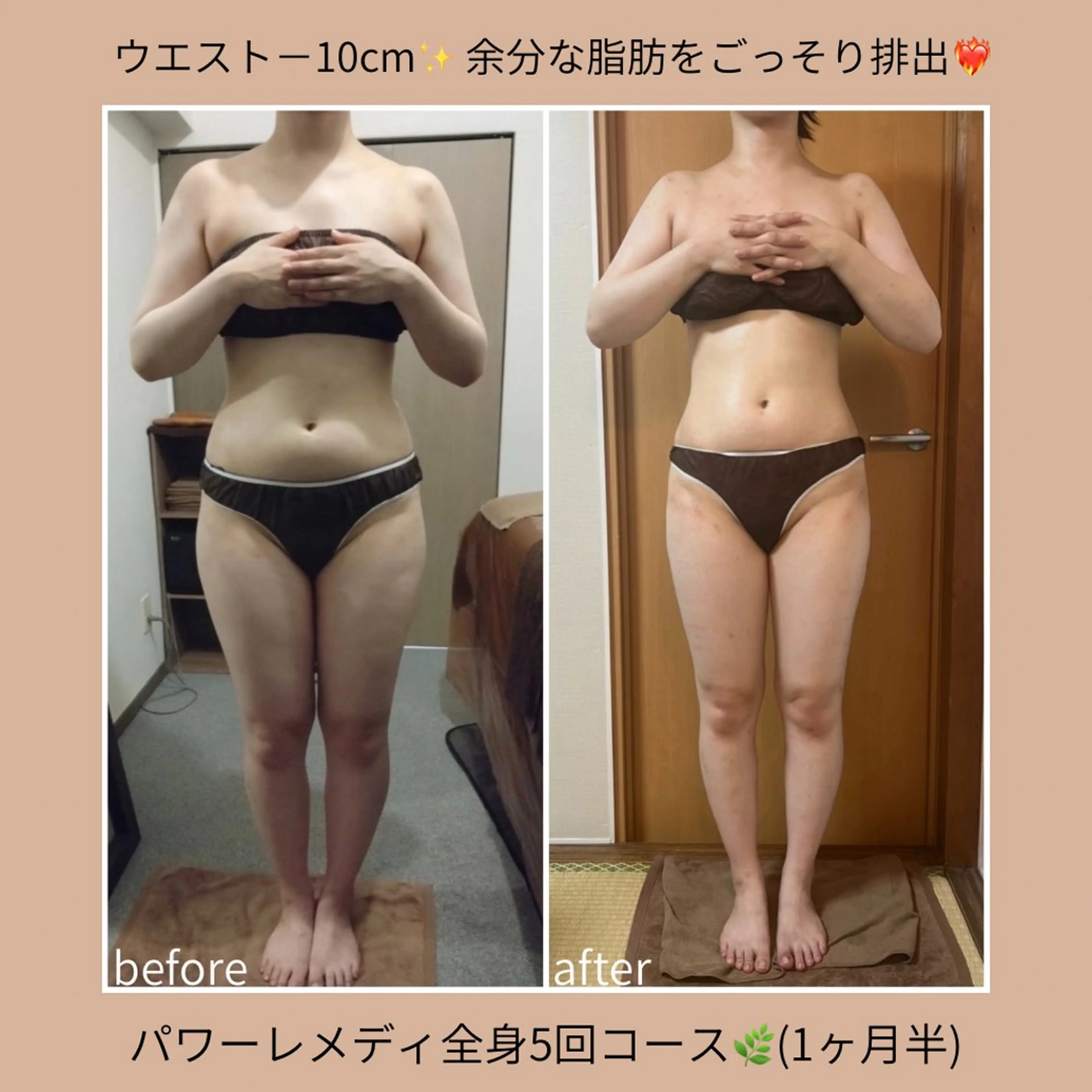 《本気痩せ×疲労改善 》  BILOOPのエステ・リラクイメージ