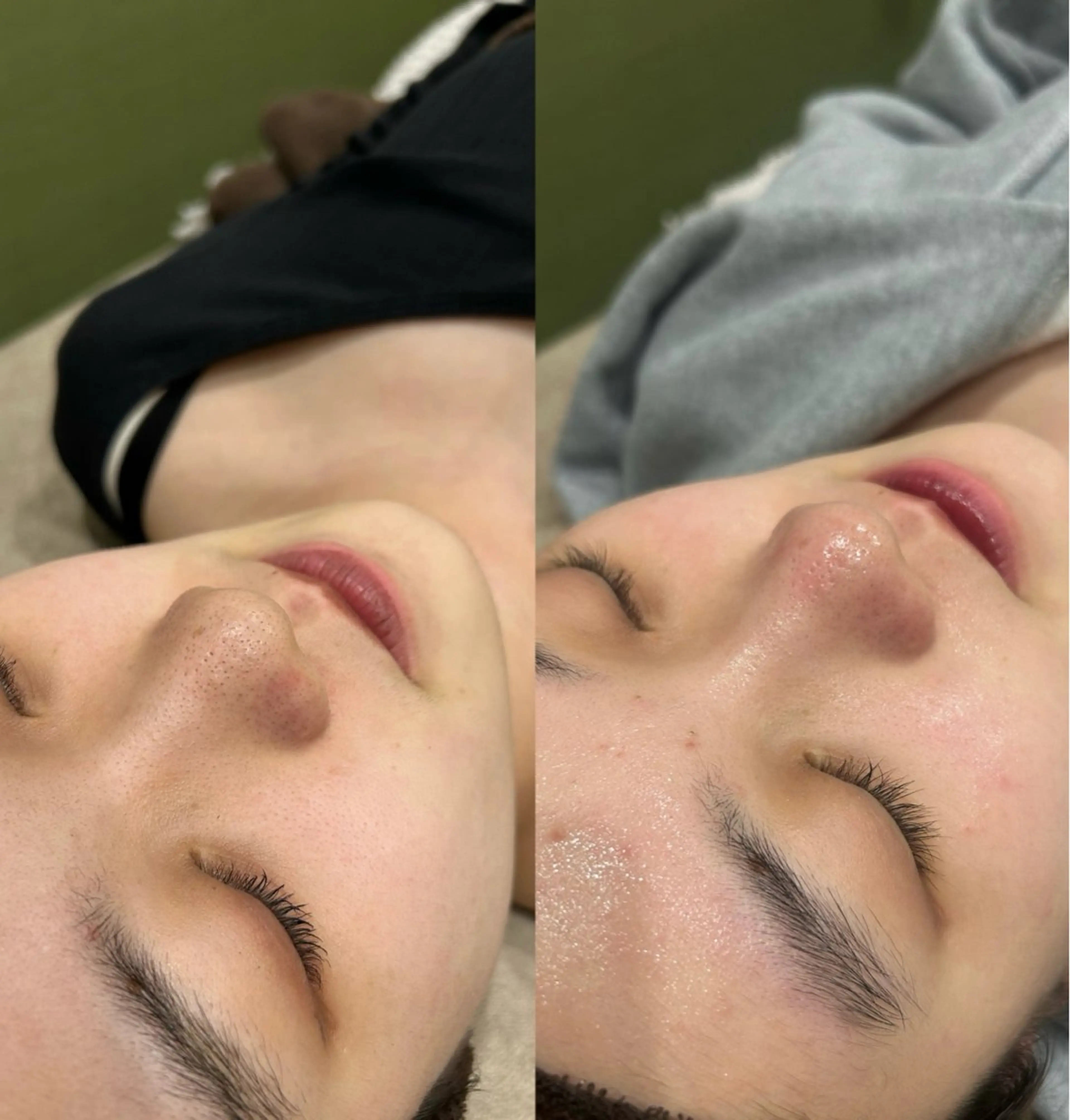 美容革命ラボ 春吉店のエステ・リラクイメージ