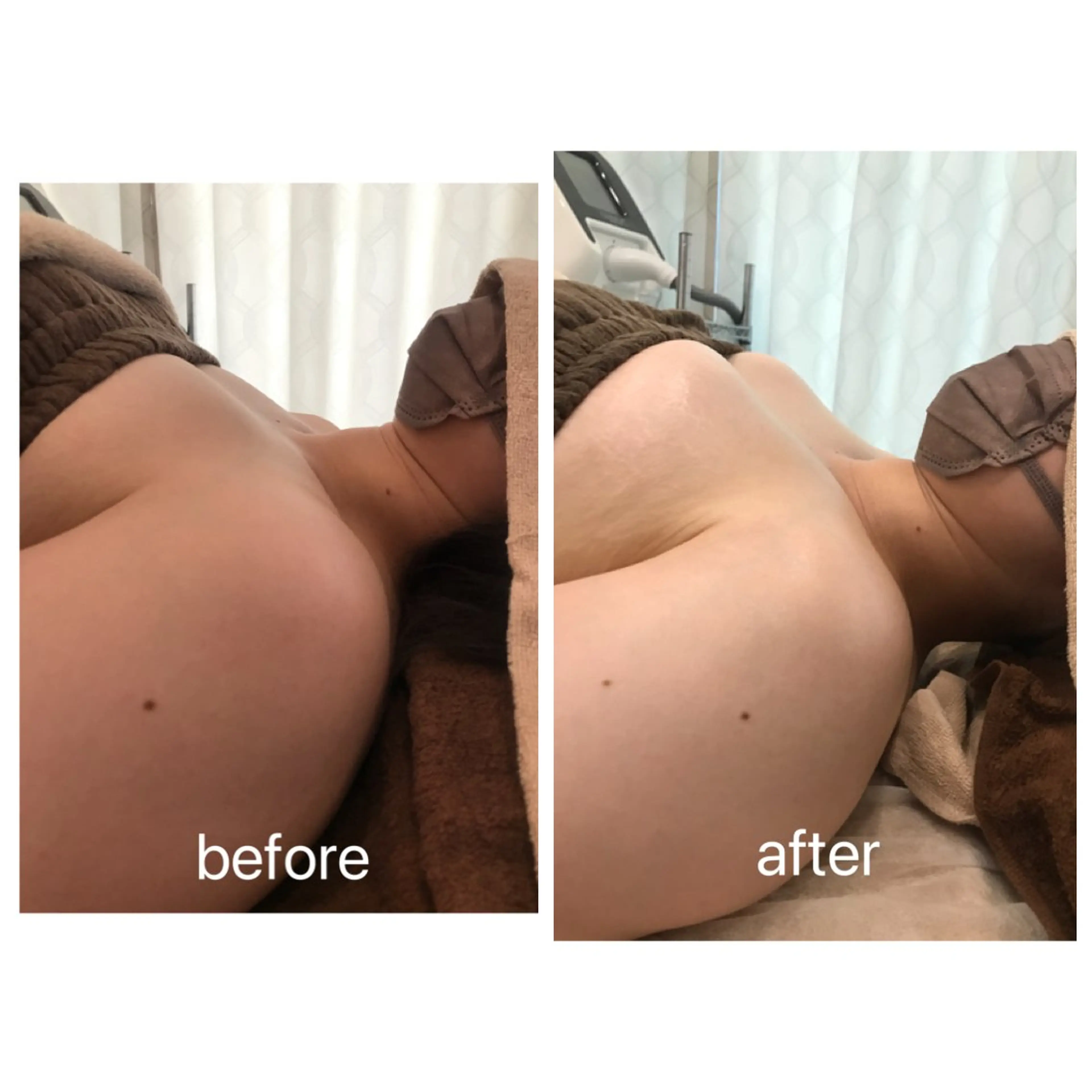 Rene 慢性疲労ケアサロンのエステ・リラクイメージ