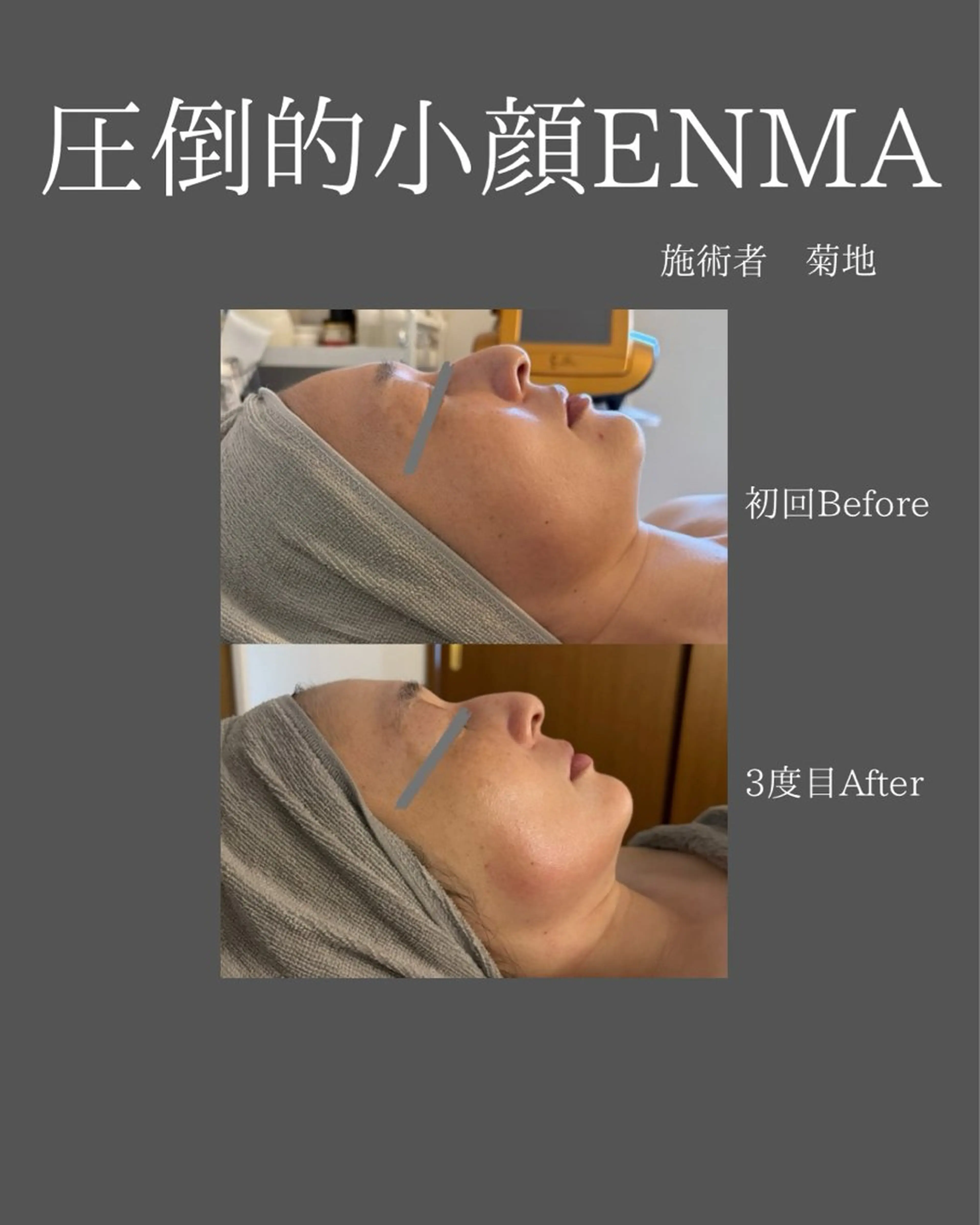 BLOSSOM 菊地のエステ・リラクイメージ