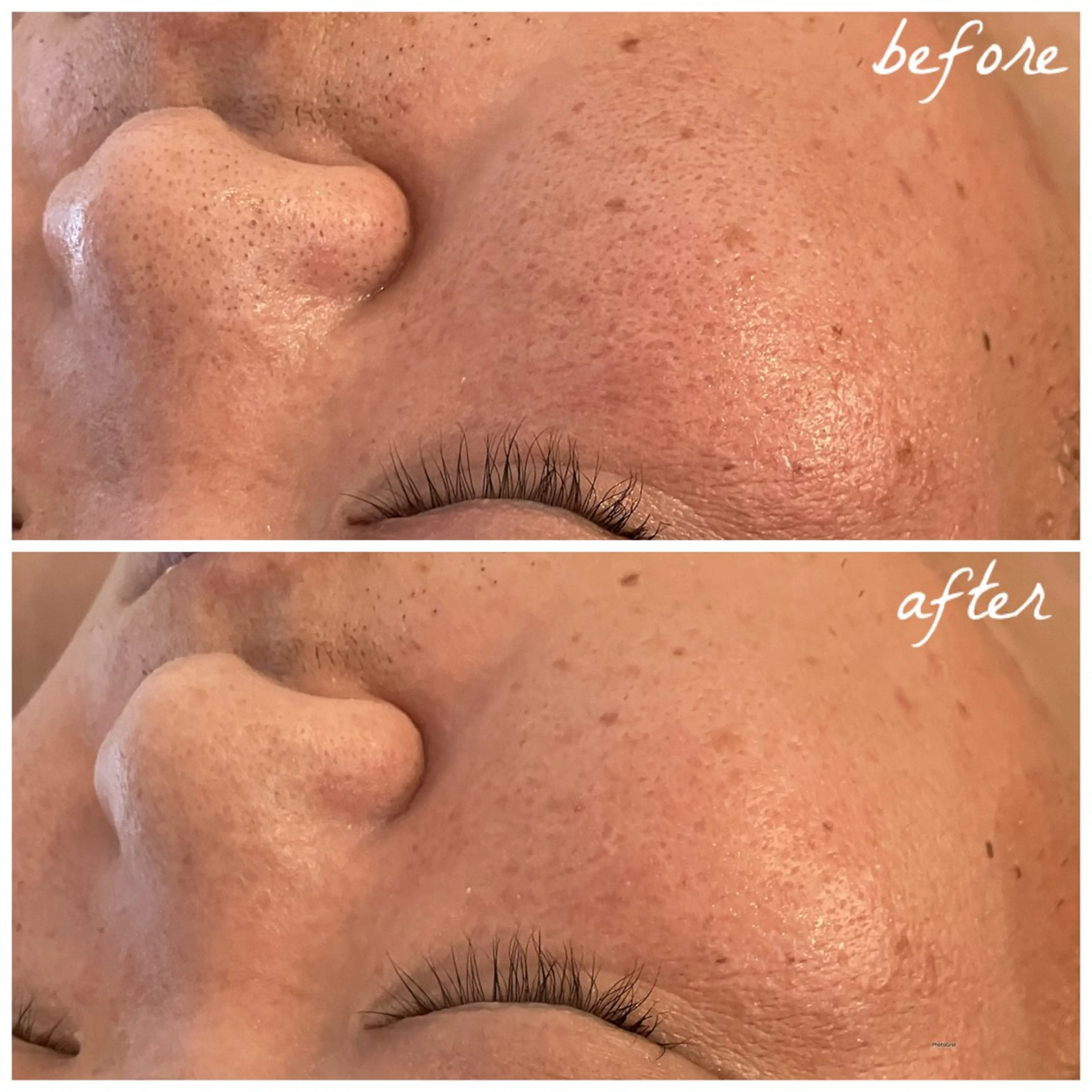 メンズ エステ メナード岐阜茜部 杉浦のエステ・リラクイメージ