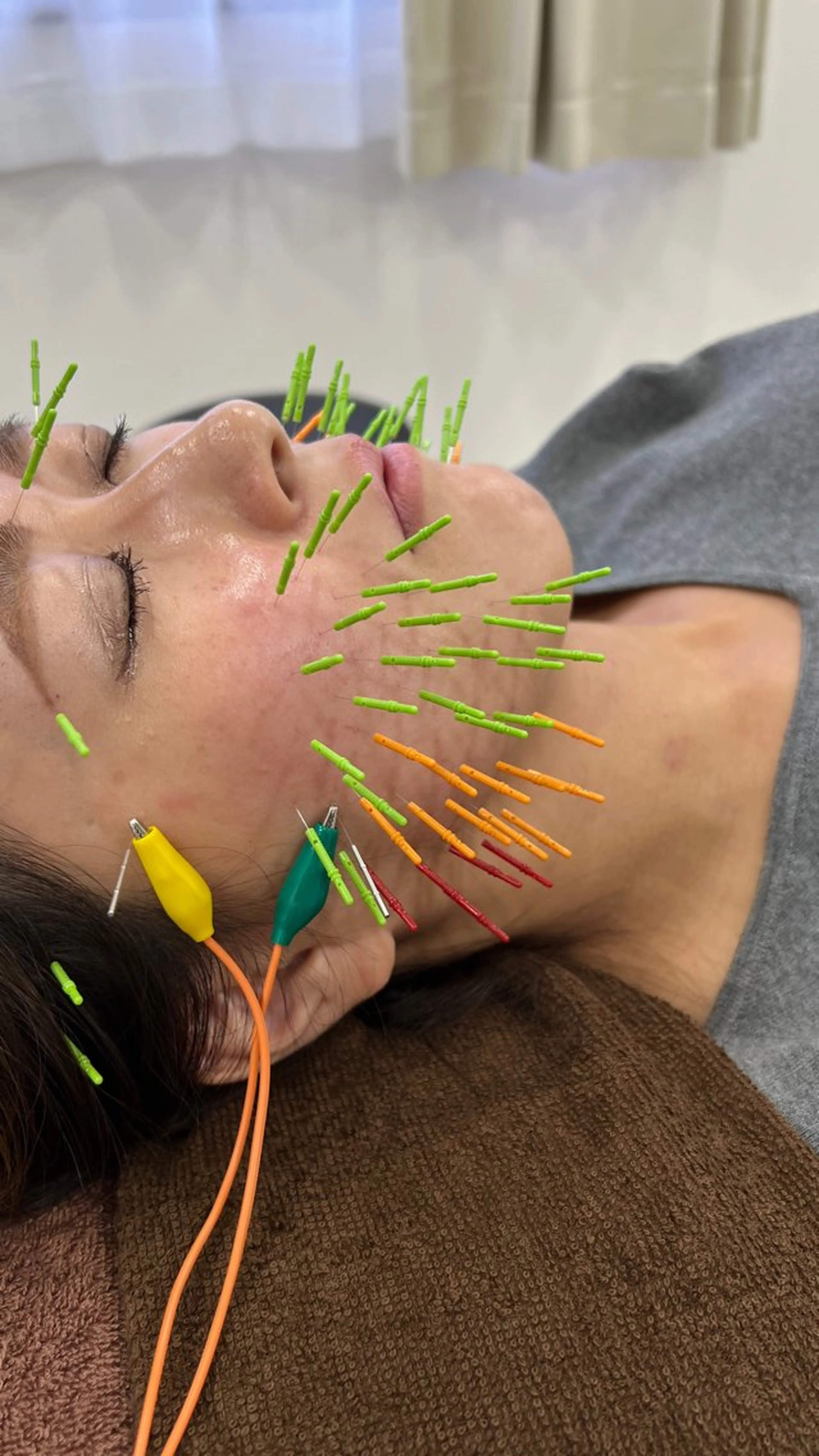 リラク 美容鍼×小顔×猫背× ブライダル 大阪梅田のエステ・リラクイメージ