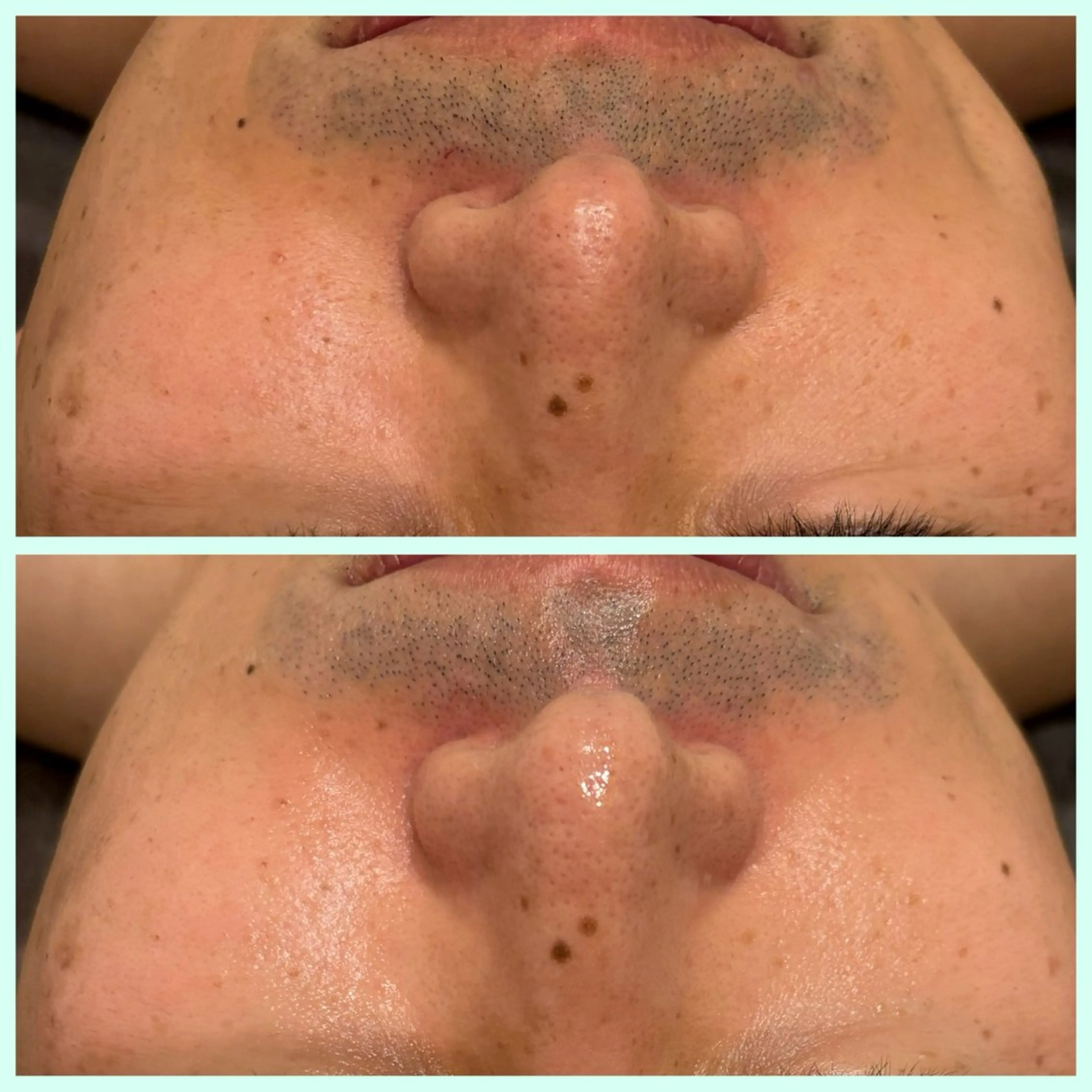 メンズ 小顔コルギ ☆表参道/外苑前のエステ・リラクイメージ