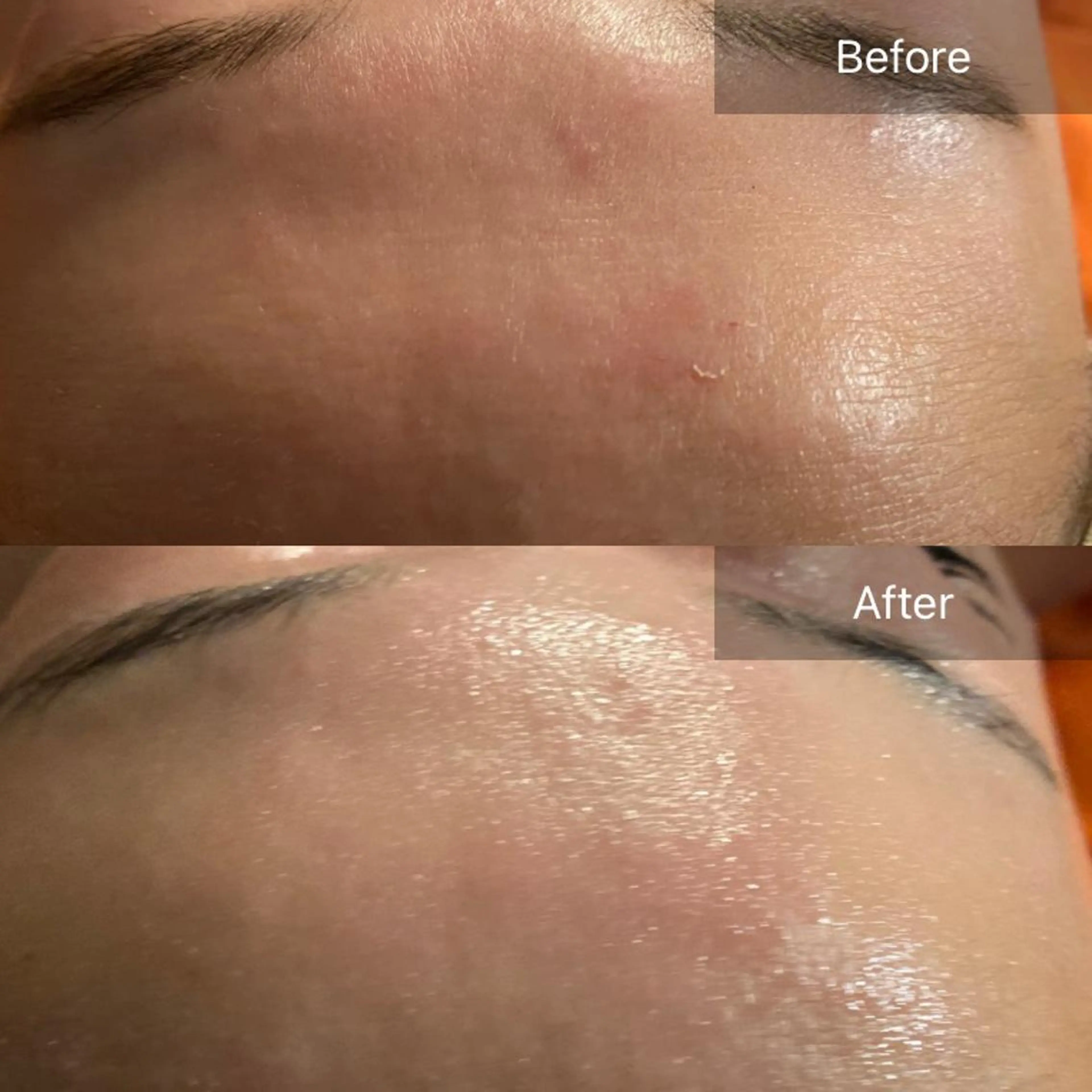 Mandarin Orange所属・毛穴から始める肌メン テマンダリンオレンジのエステ・リラクイメージ