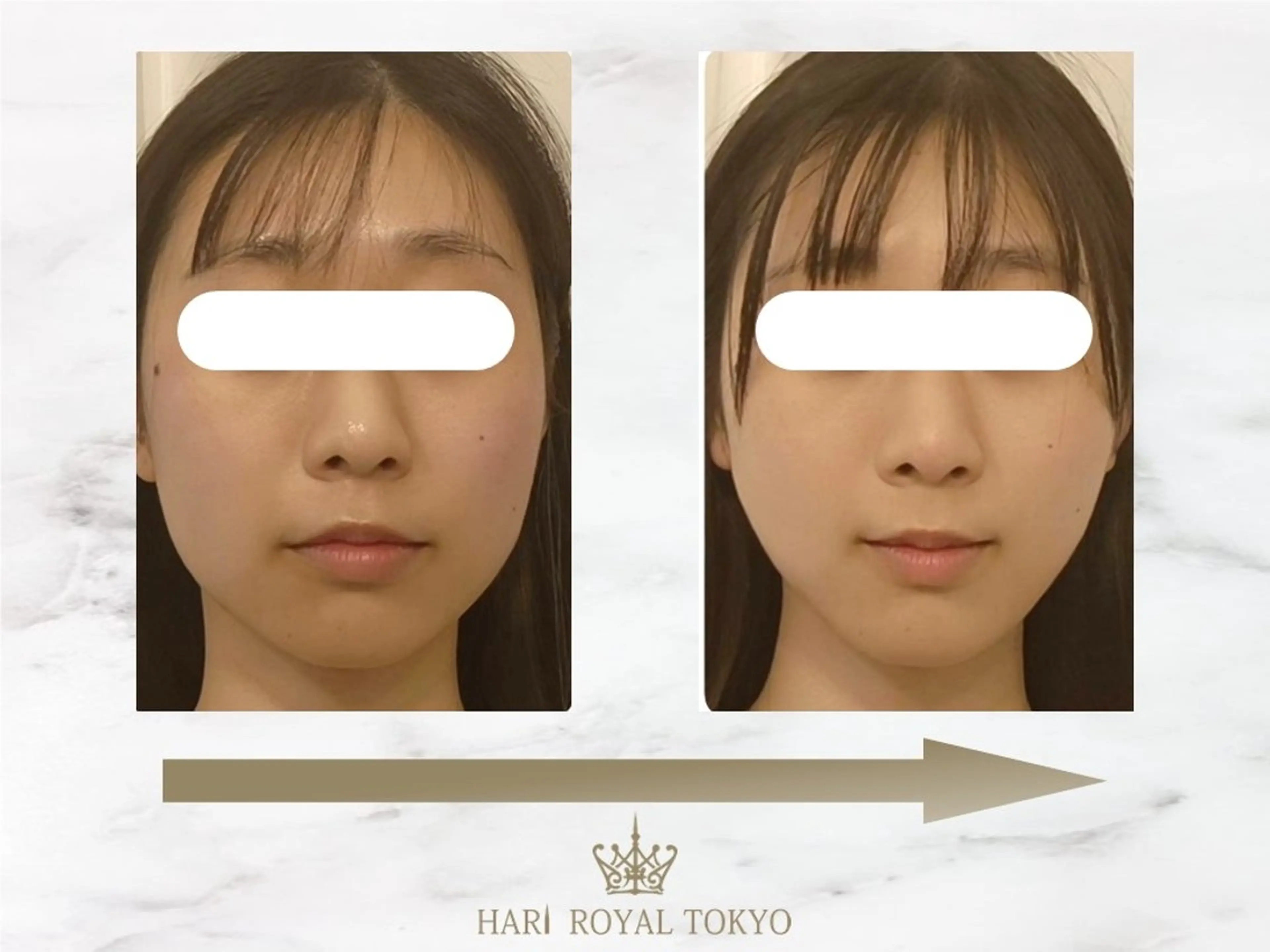 エステ ニューハーフ鍼灸師 🖤🤍Saya🌹のエステ・リラクイメージ