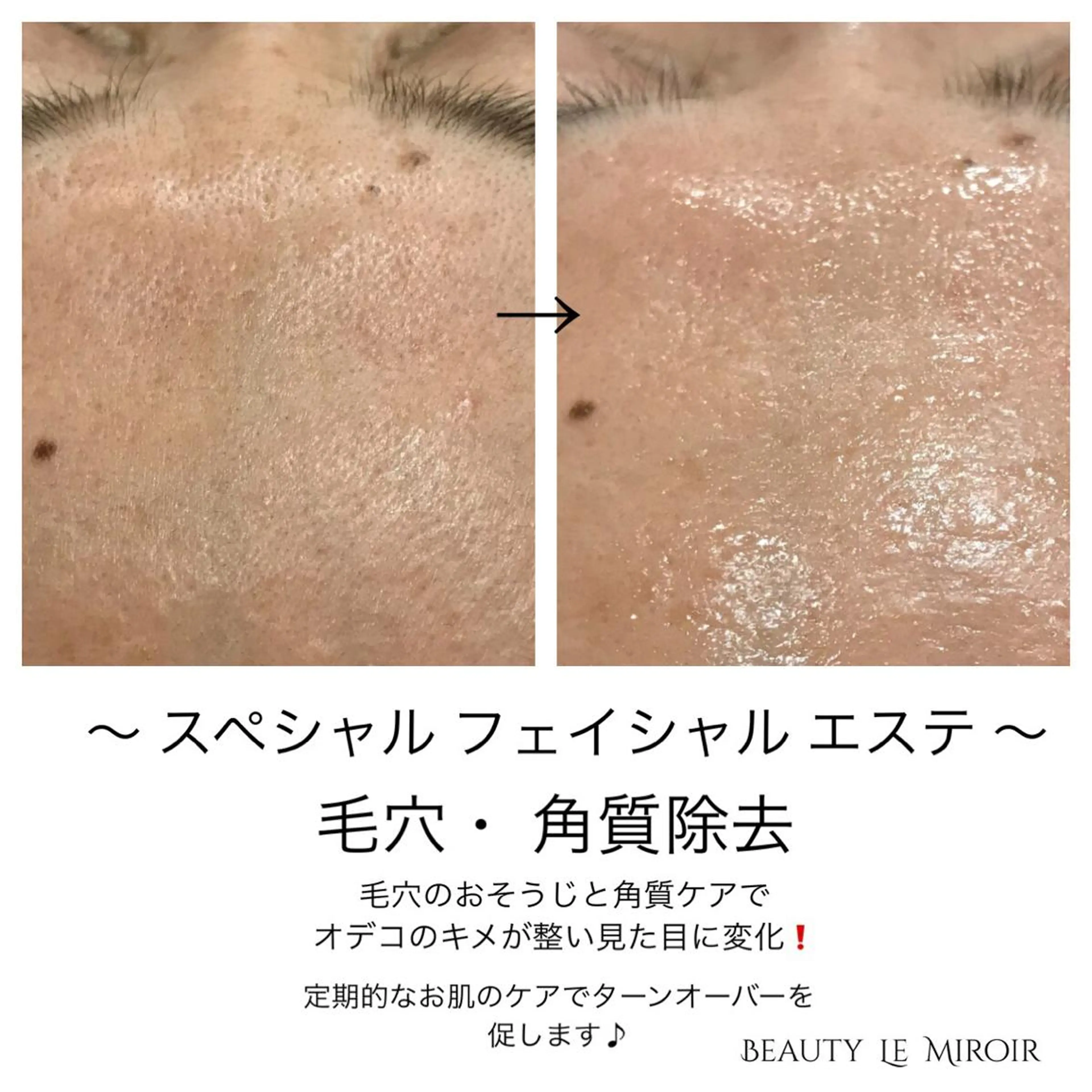 ビューティー ミロワールのエステ・リラクイメージ