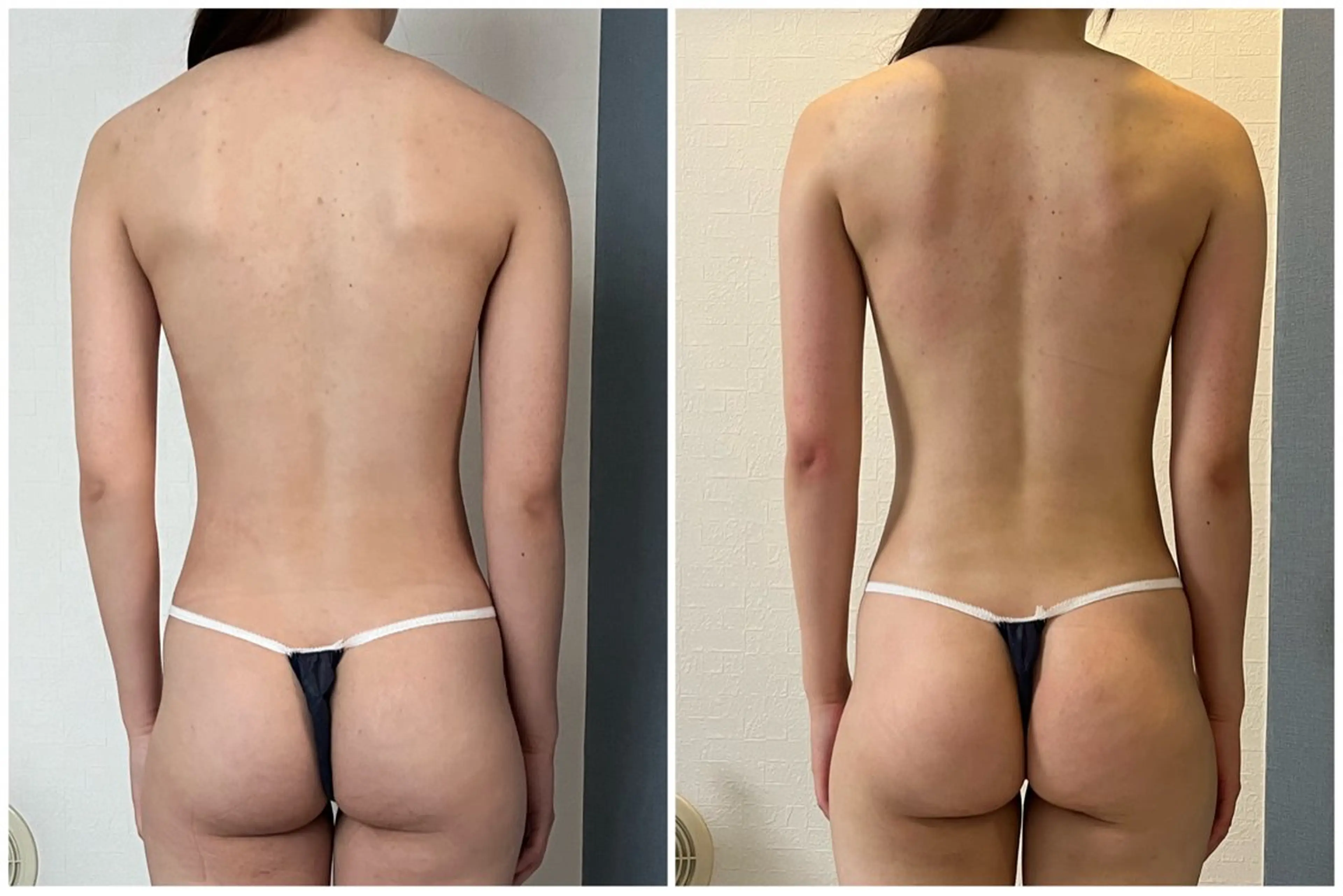 エステ リラク 湘南エステサロン moaのエステ・リラクイメージ