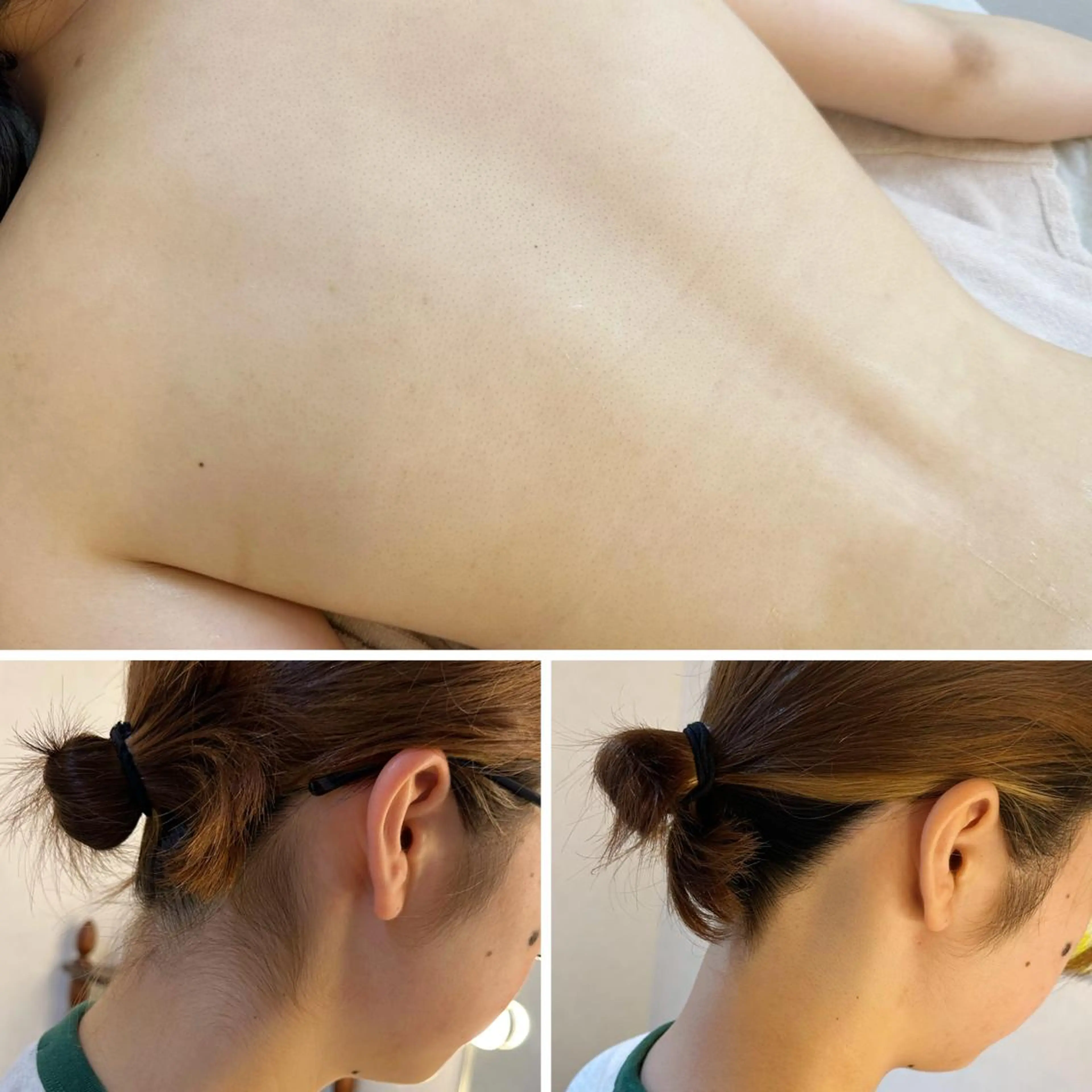 脱毛 うなじ脱毛/美肌脱毛 LABELのエステ・リラクイメージ