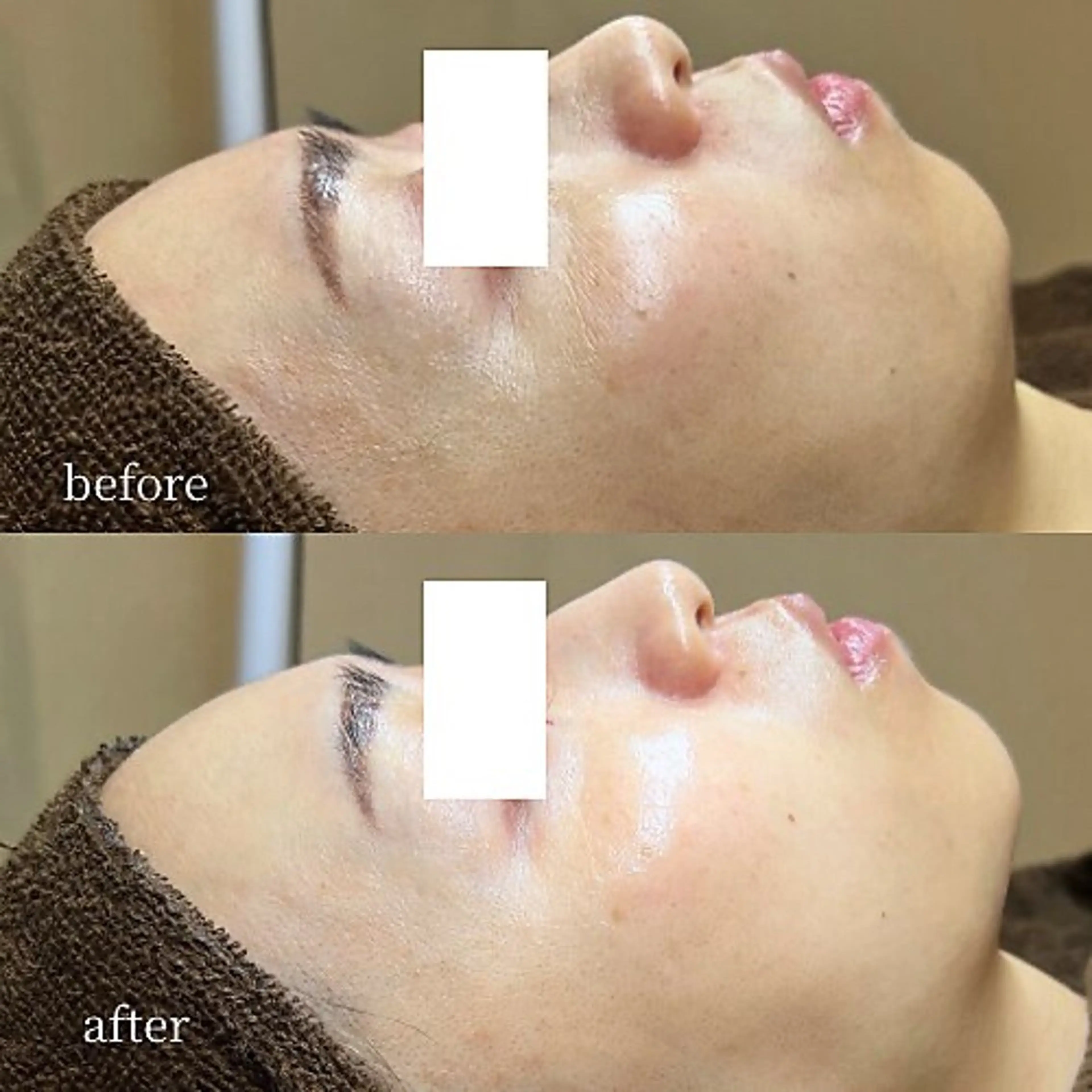 韓国肌管理・肌質改善 EARNEST心斎橋のエステ・リラクイメージ