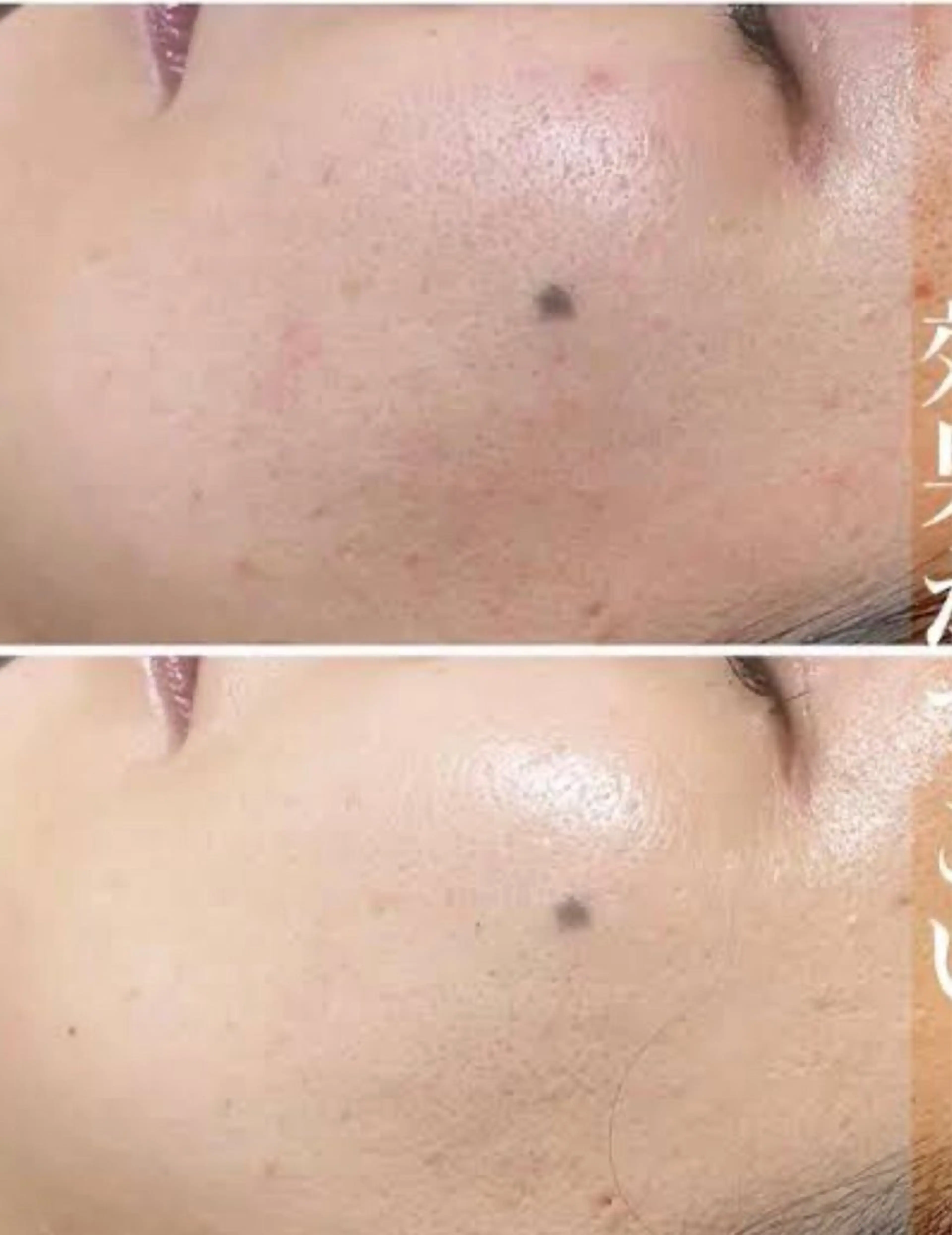 エステ ☺ハーブピール💕 ソフィアカロン💖のエステ・リラクイメージ