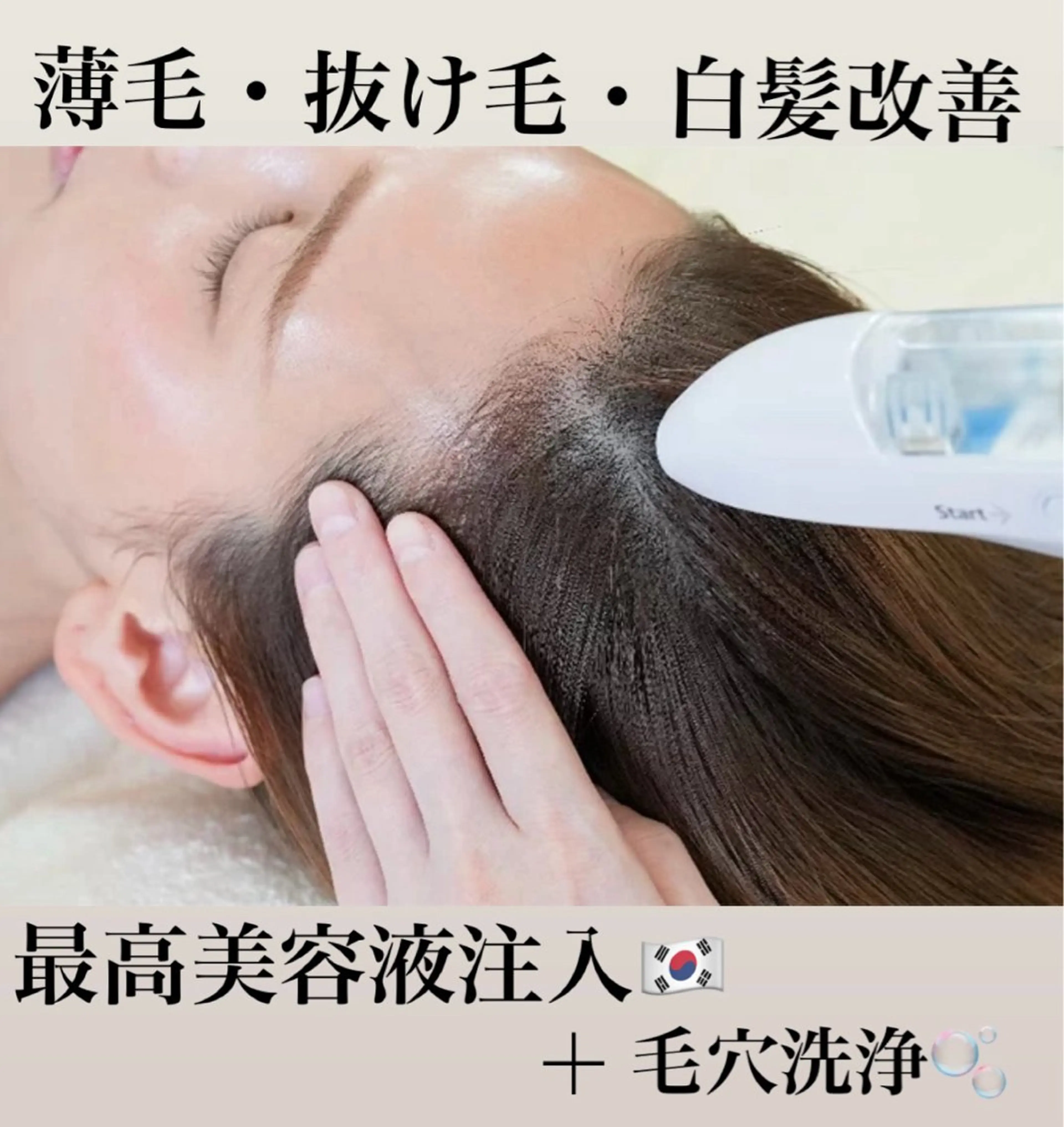 【育毛促進/白髪防止/頭皮ニオイ】頭皮環境改善ケアコース　🫧¥15,000→¥7,500の写真