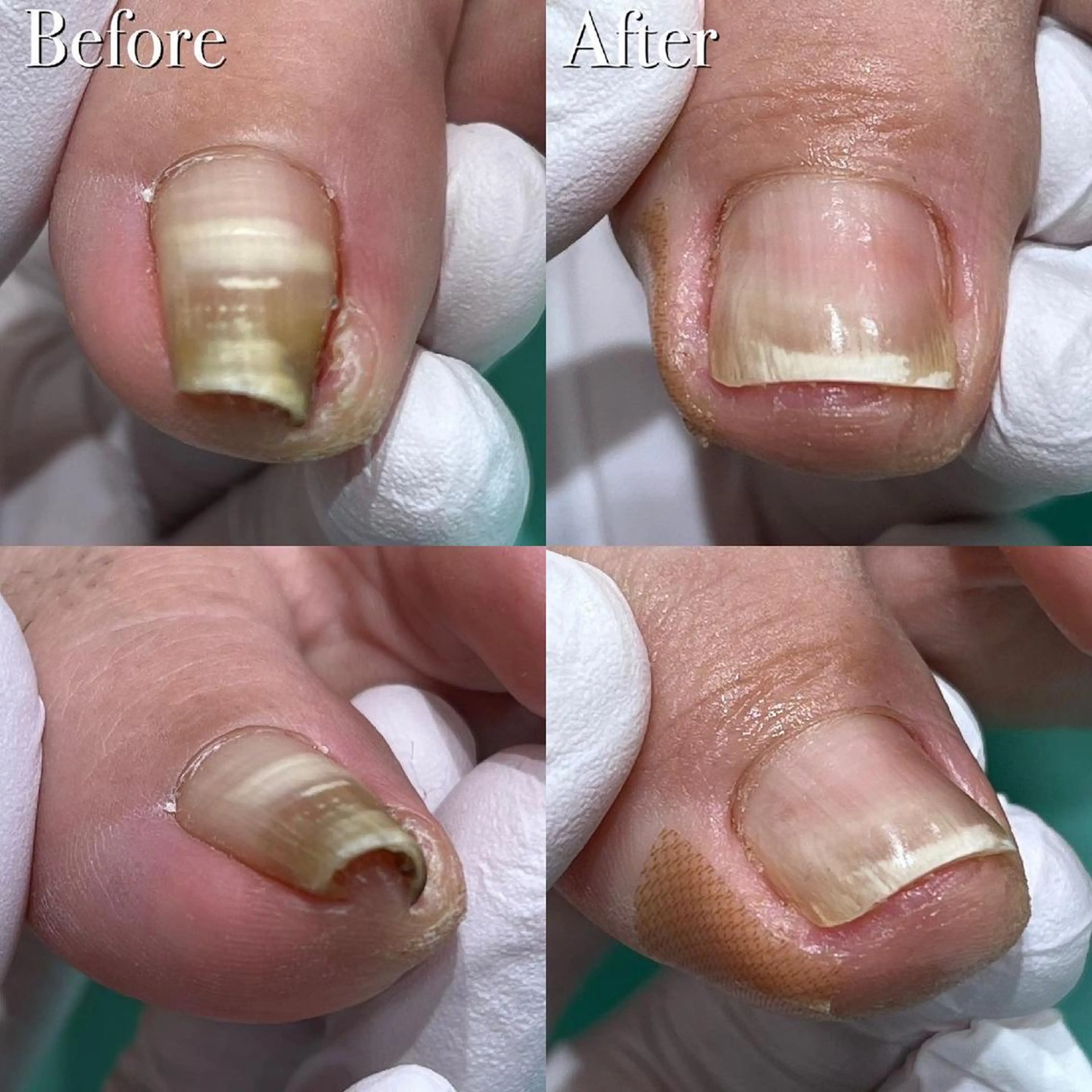 東京巻き爪アカデミー所属・東京巻き爪 アカデミーのエステ・リラクイメージ