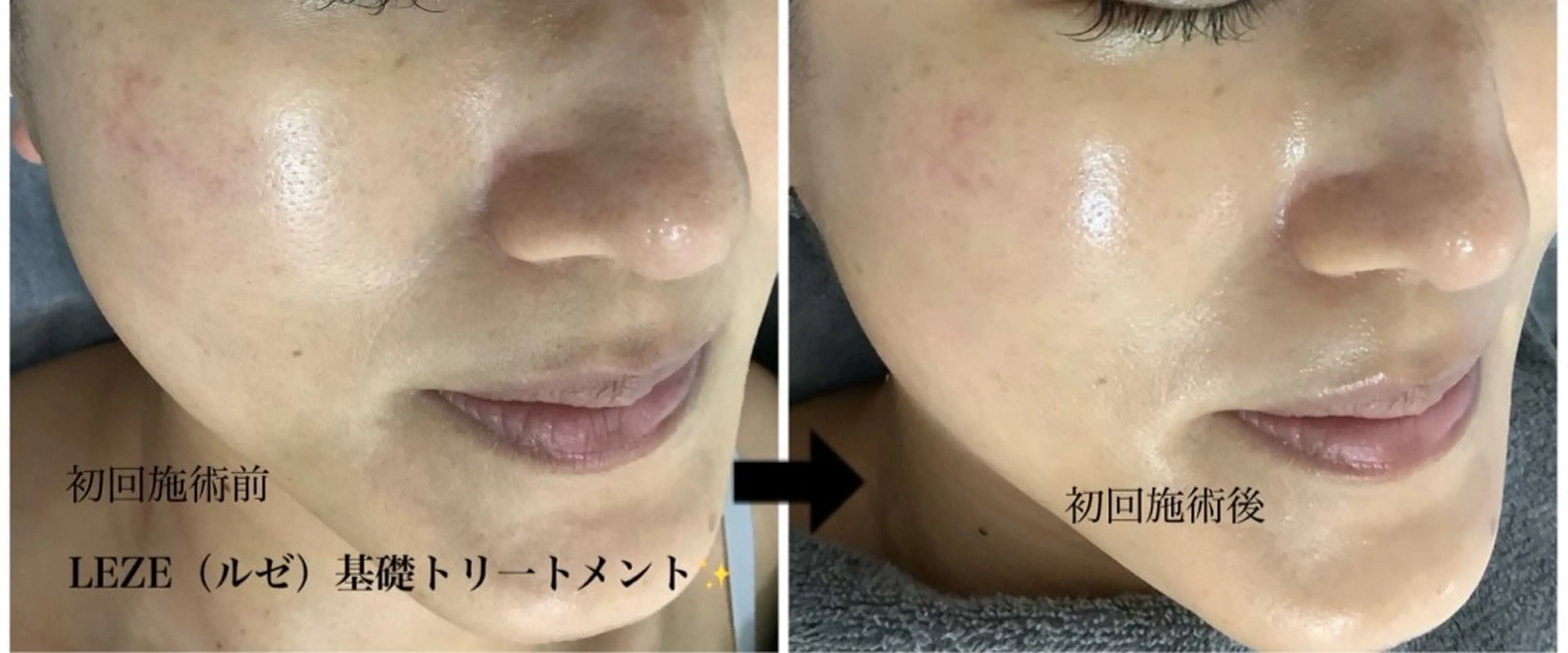 エステ 🩵Tatsumi Kana🩵のエステ・リラクイメージ