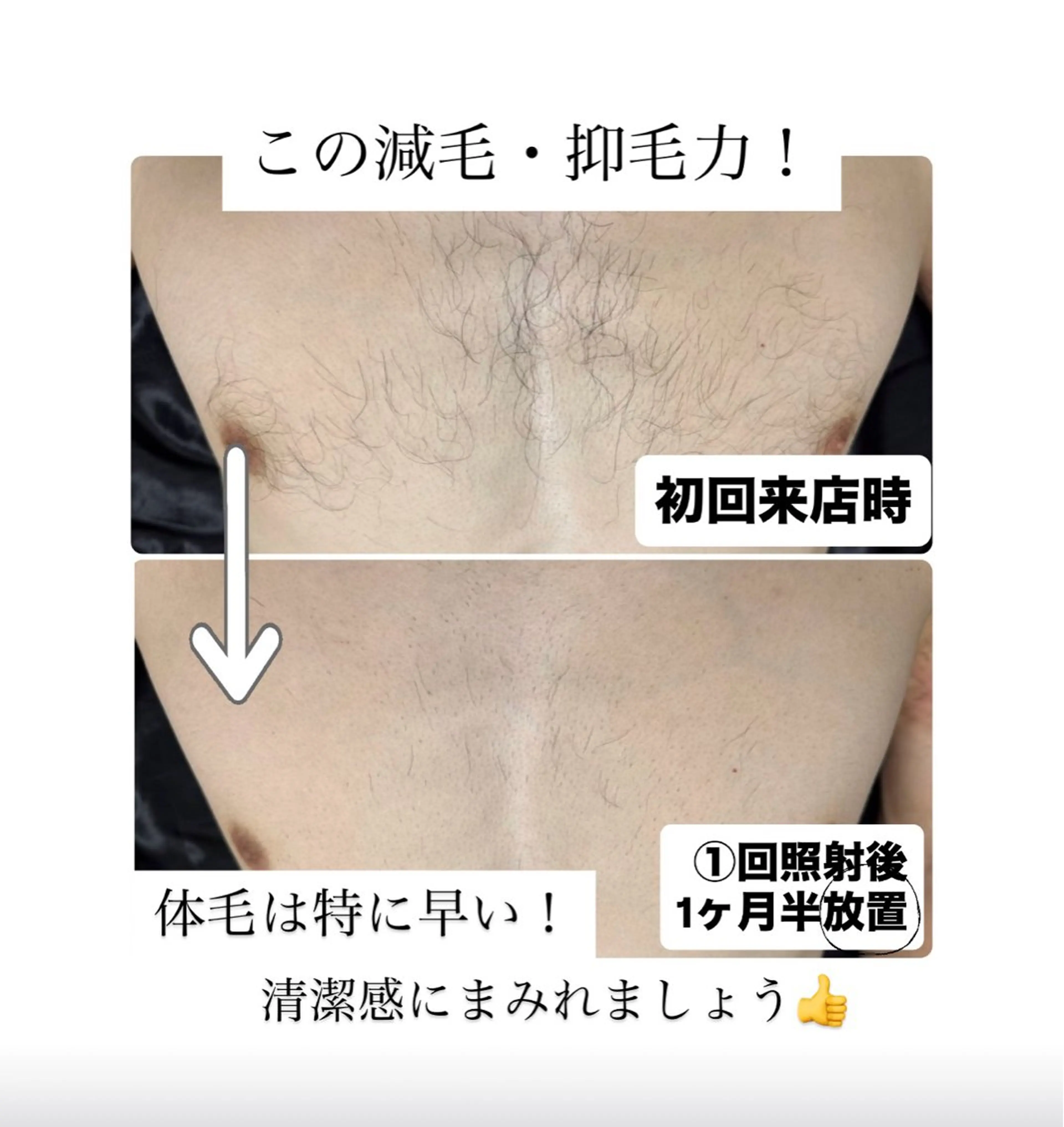 メンズ 脱毛 メンズ脱毛サロン Le falcoのエステ・リラクイメージ