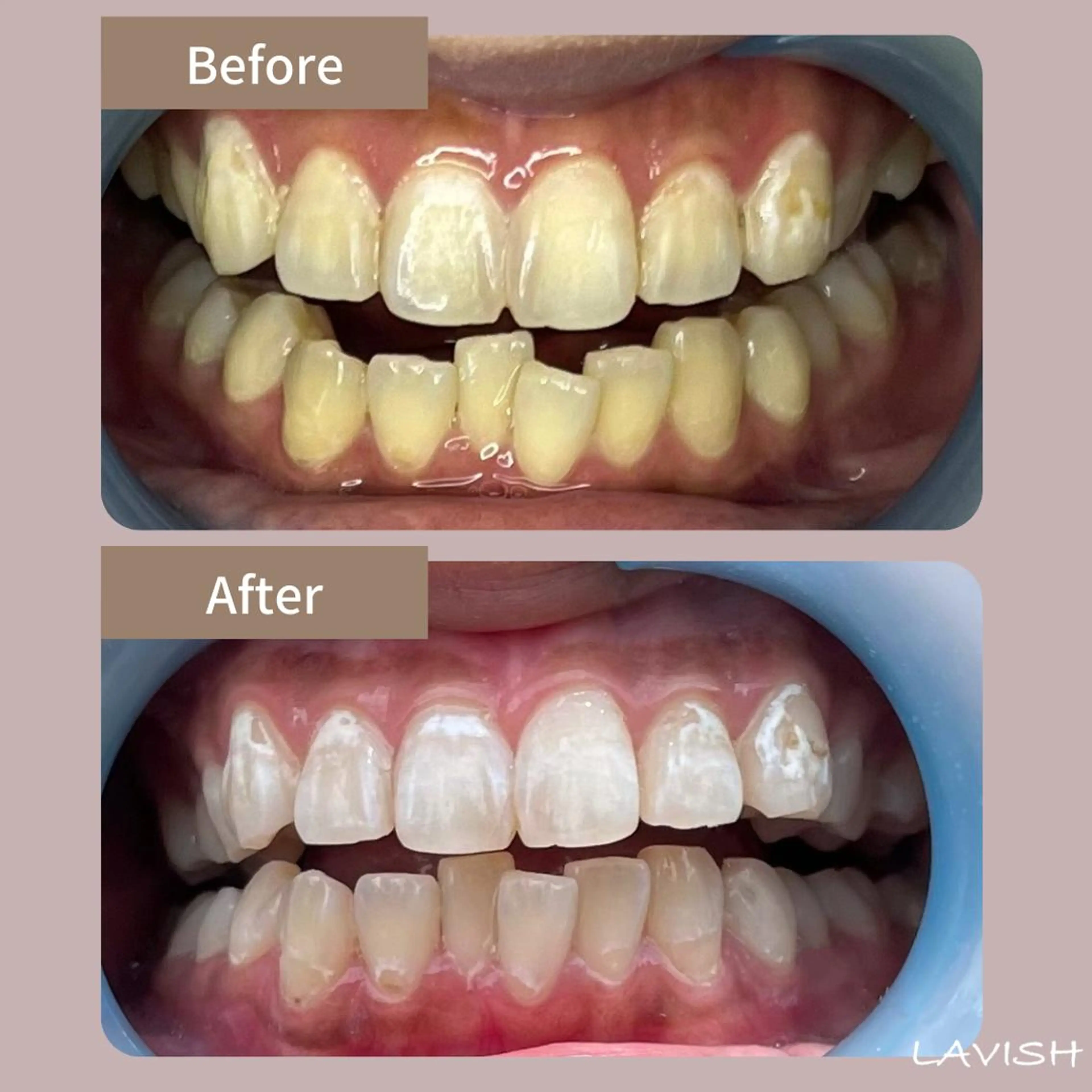 LAVISH nail salonのネイルデザイン