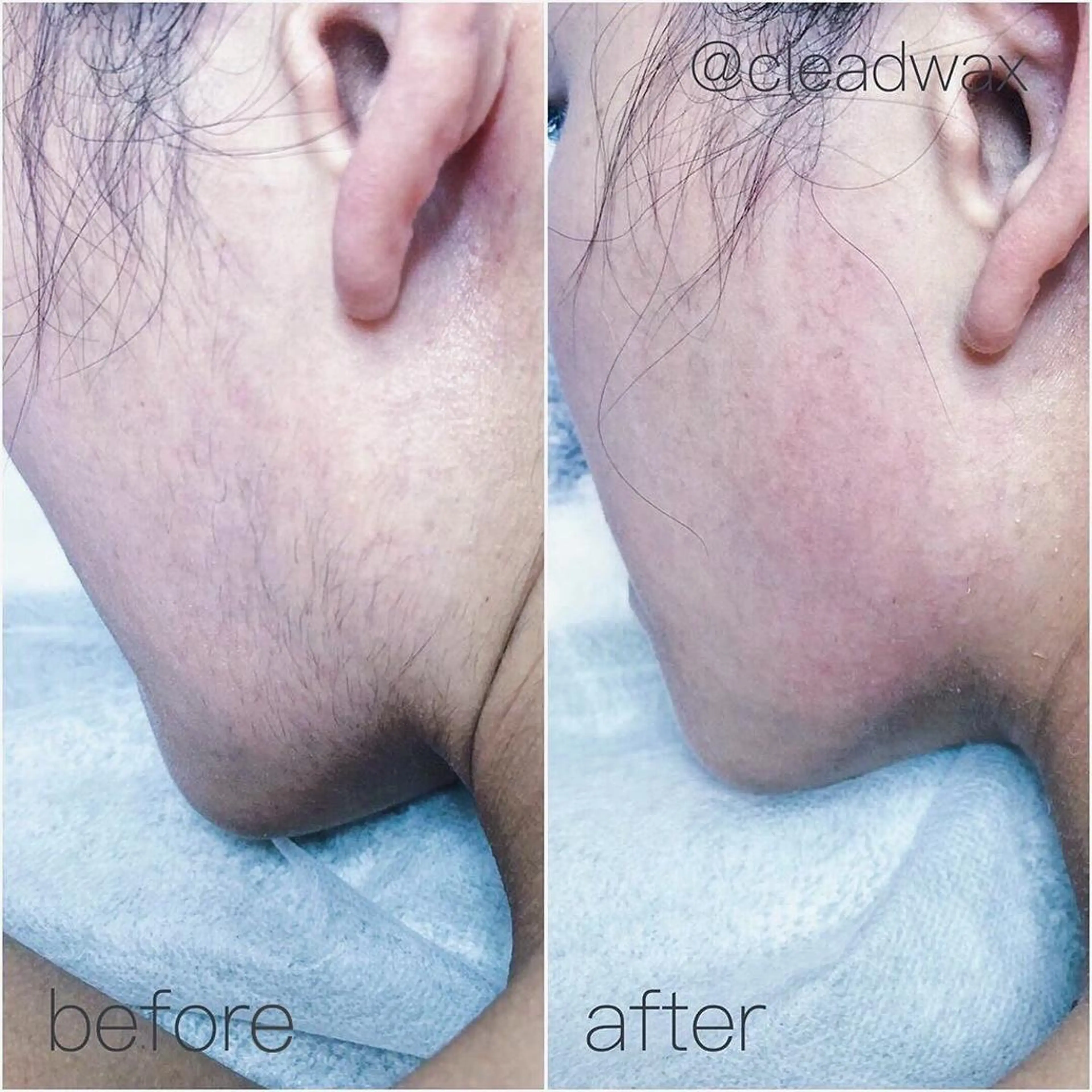 CLEAD 赤坂のエステ・リラクイメージ