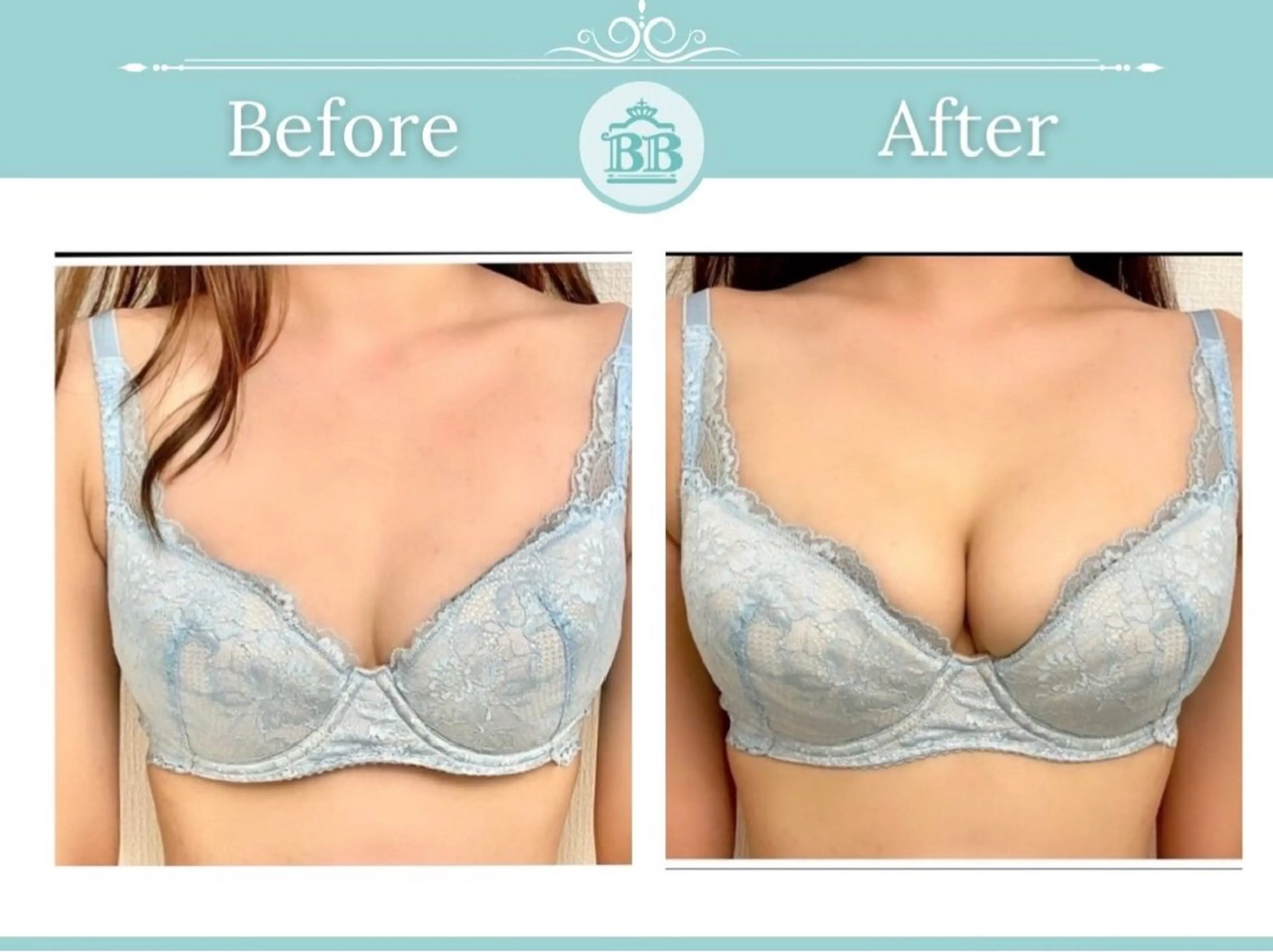 エステ 美人バスト 本厚木店のエステ・リラクイメージ