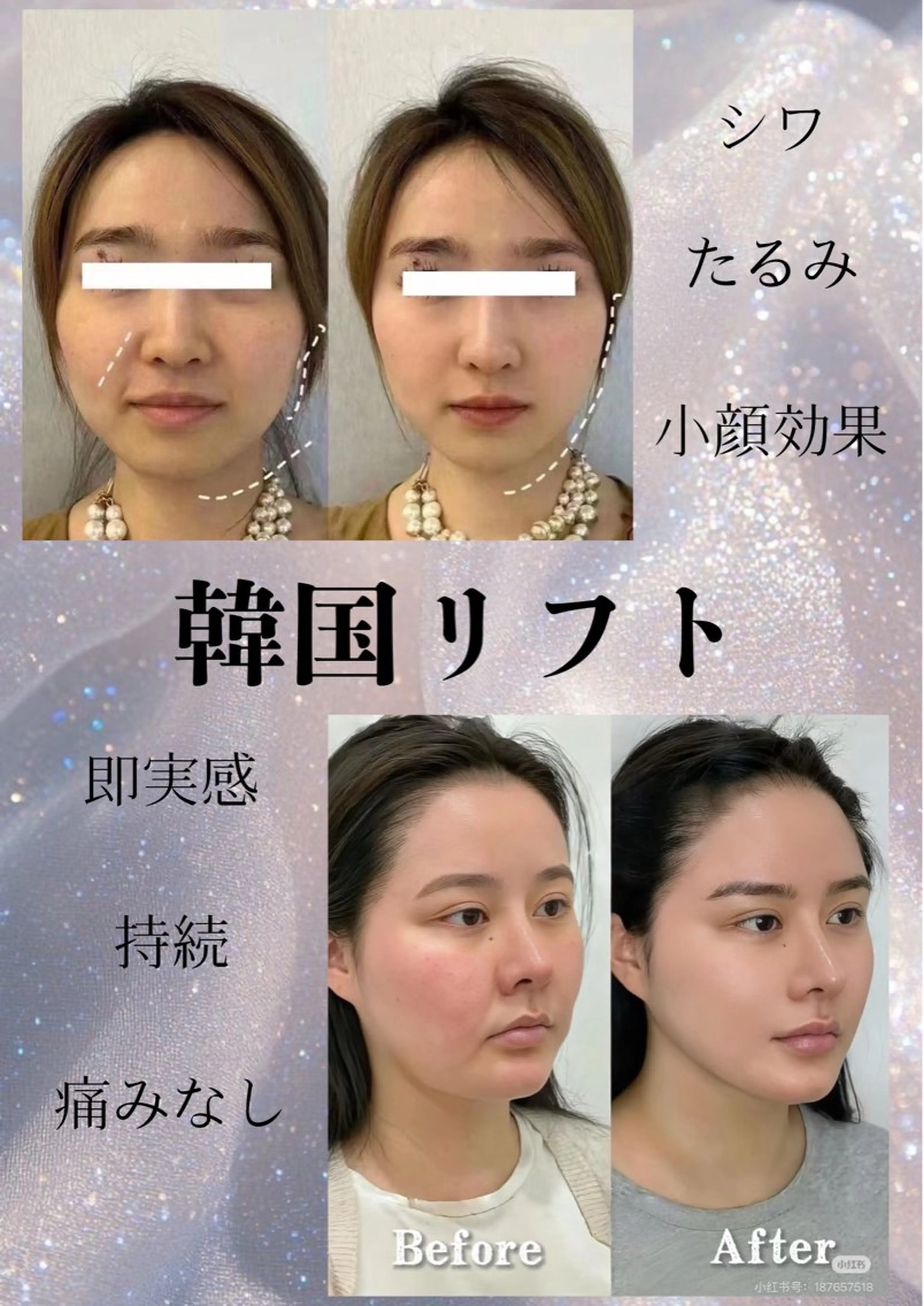 マツエク・マツパ エステ リラク 愛維美水光美肌専門店 メンズレディースokのエステ・リラクイメージ