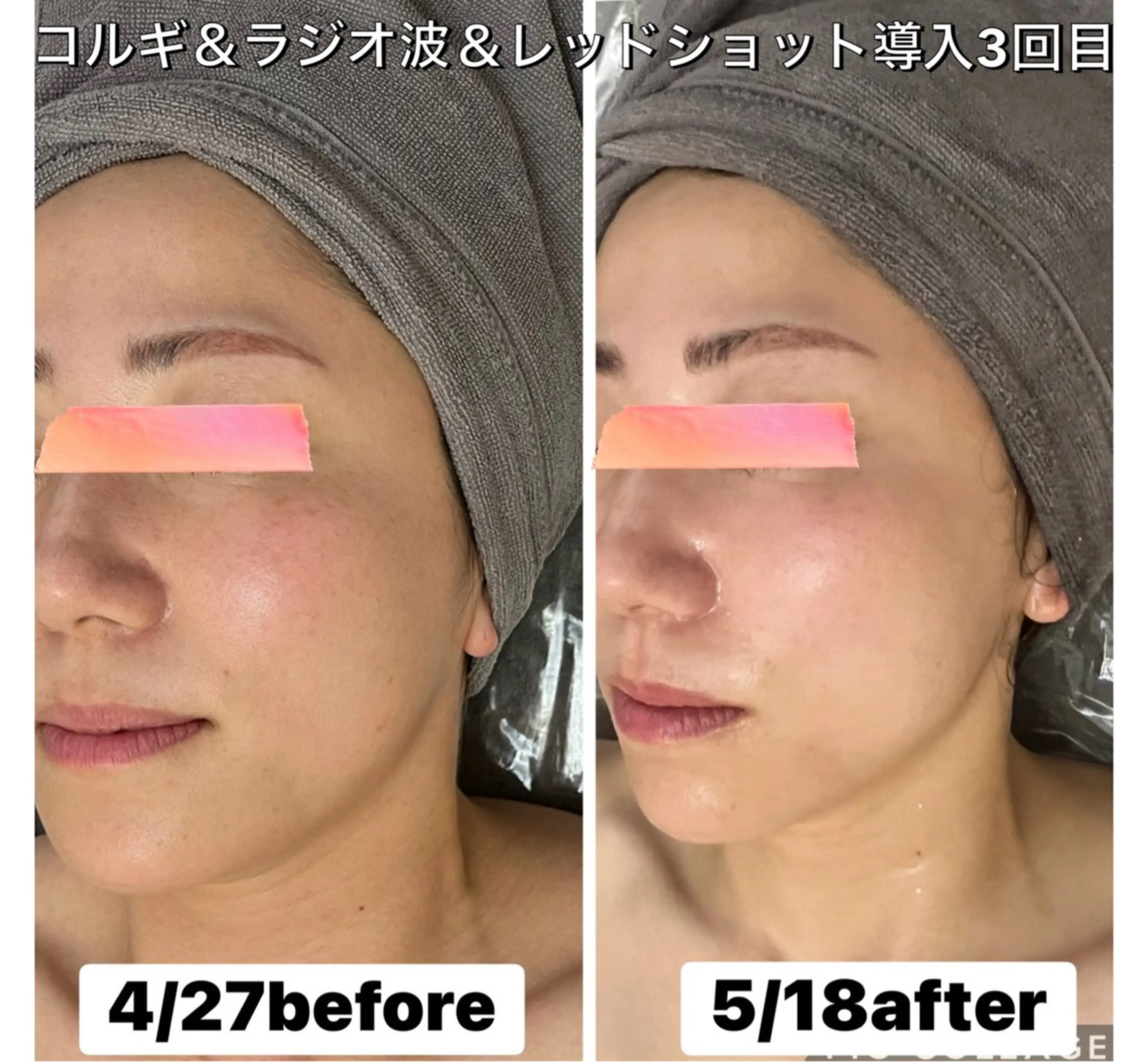 エステ SALON DE GiGiのエステ・リラクイメージ