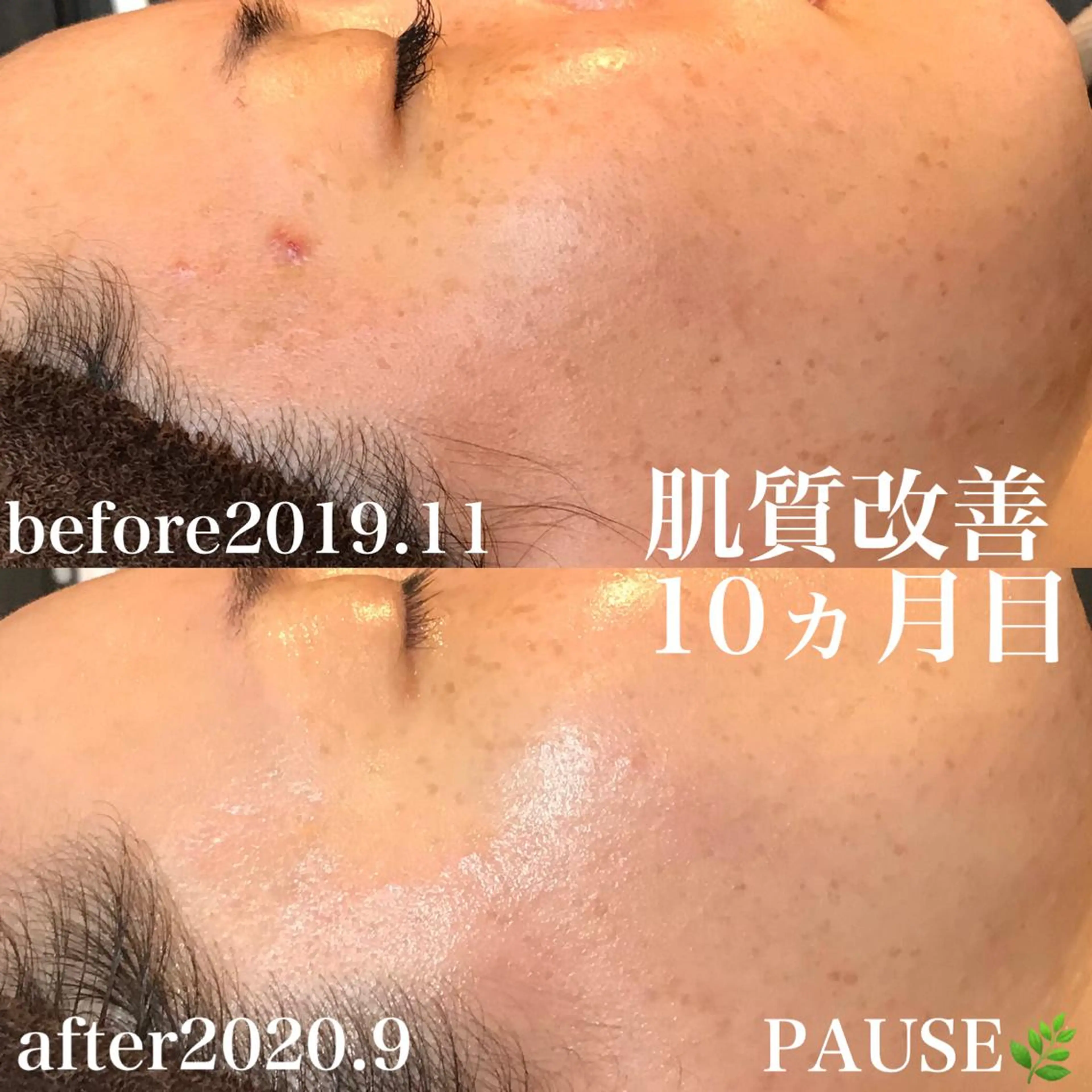 エステ 浜野 恵美のエステ・リラクイメージ