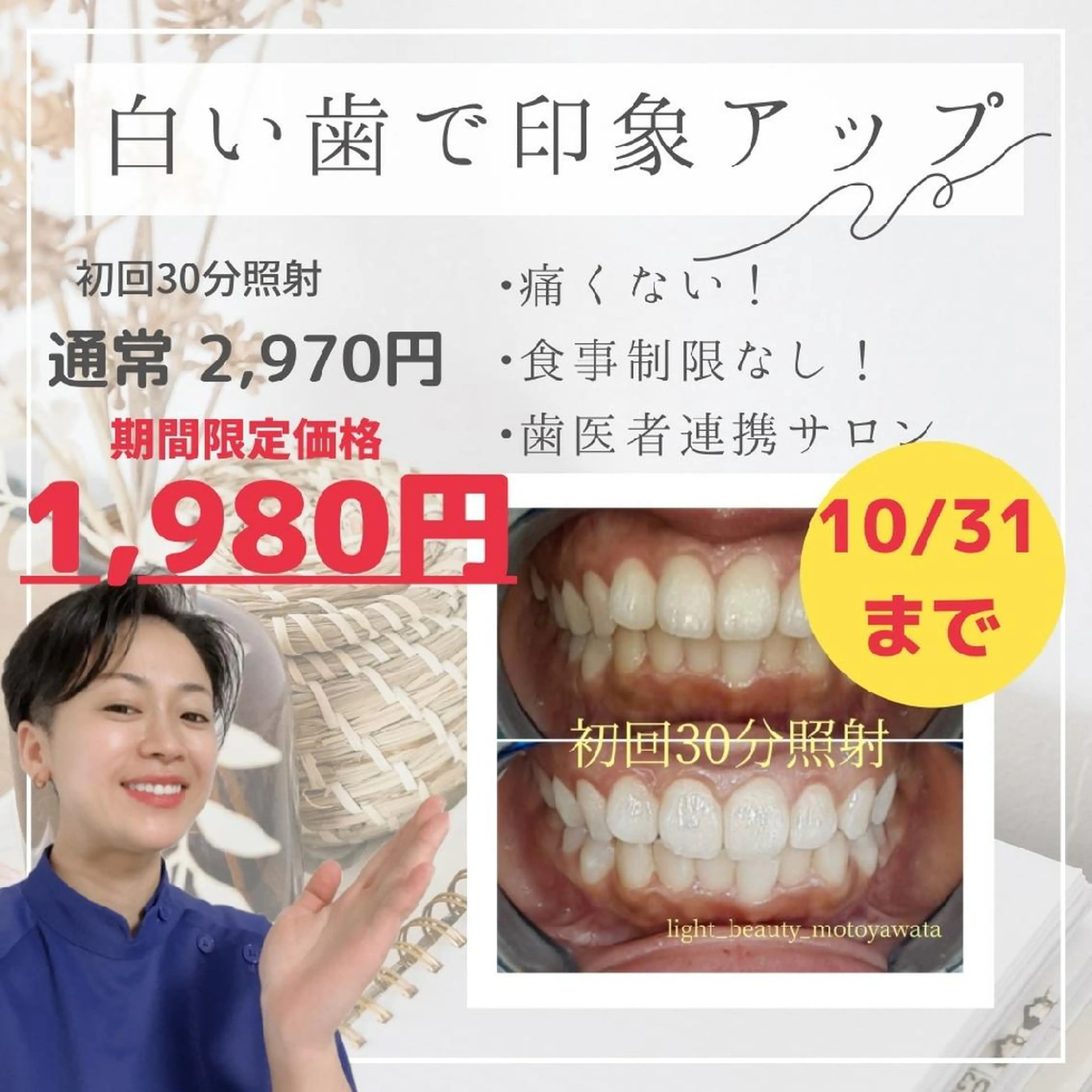 五十嵐 蓮のその他イメージ