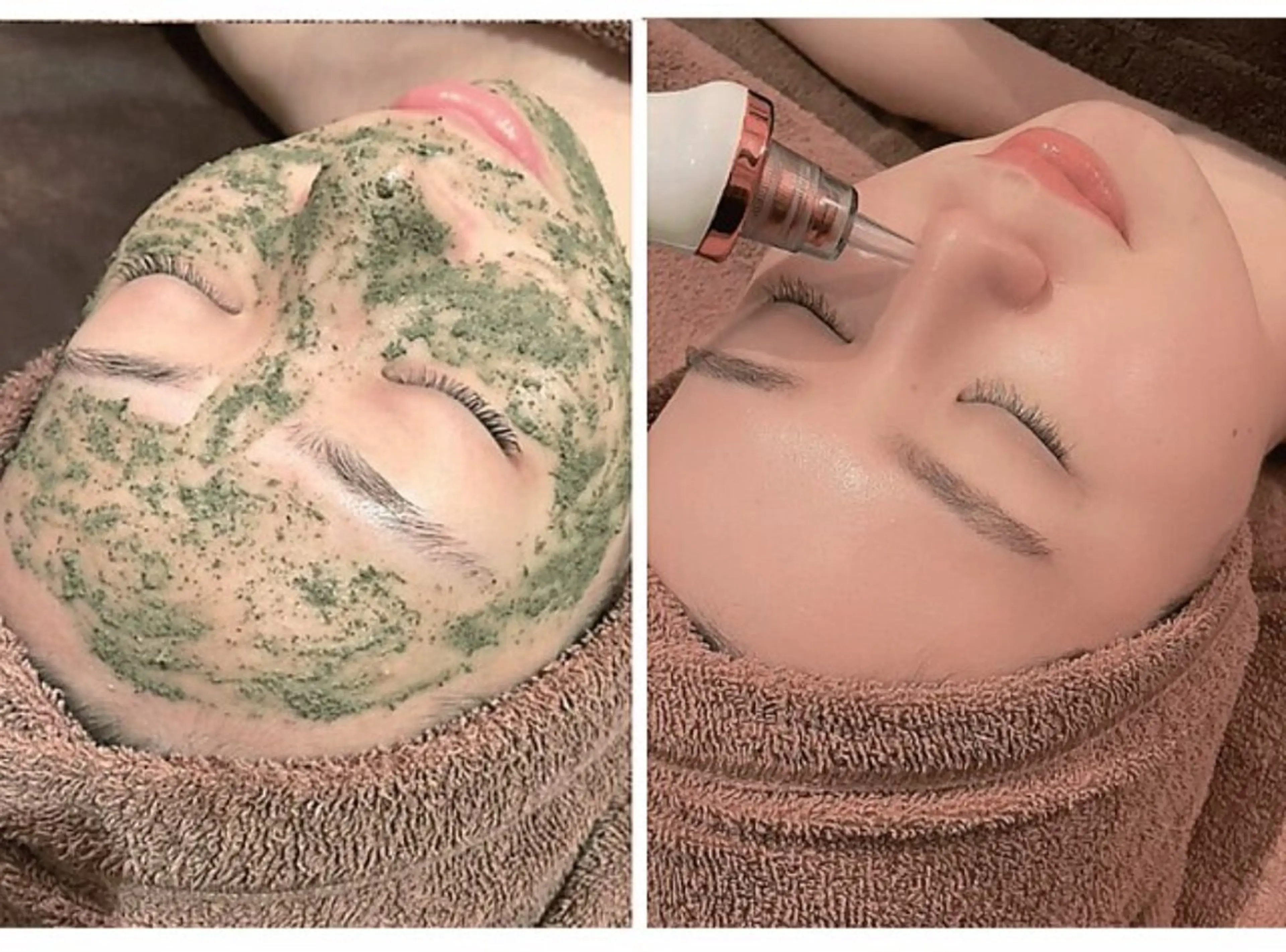 【毛穴洗浄】剥離なし♪ハーブピーリング＋毛穴吸引★《いちご鼻解消》の写真