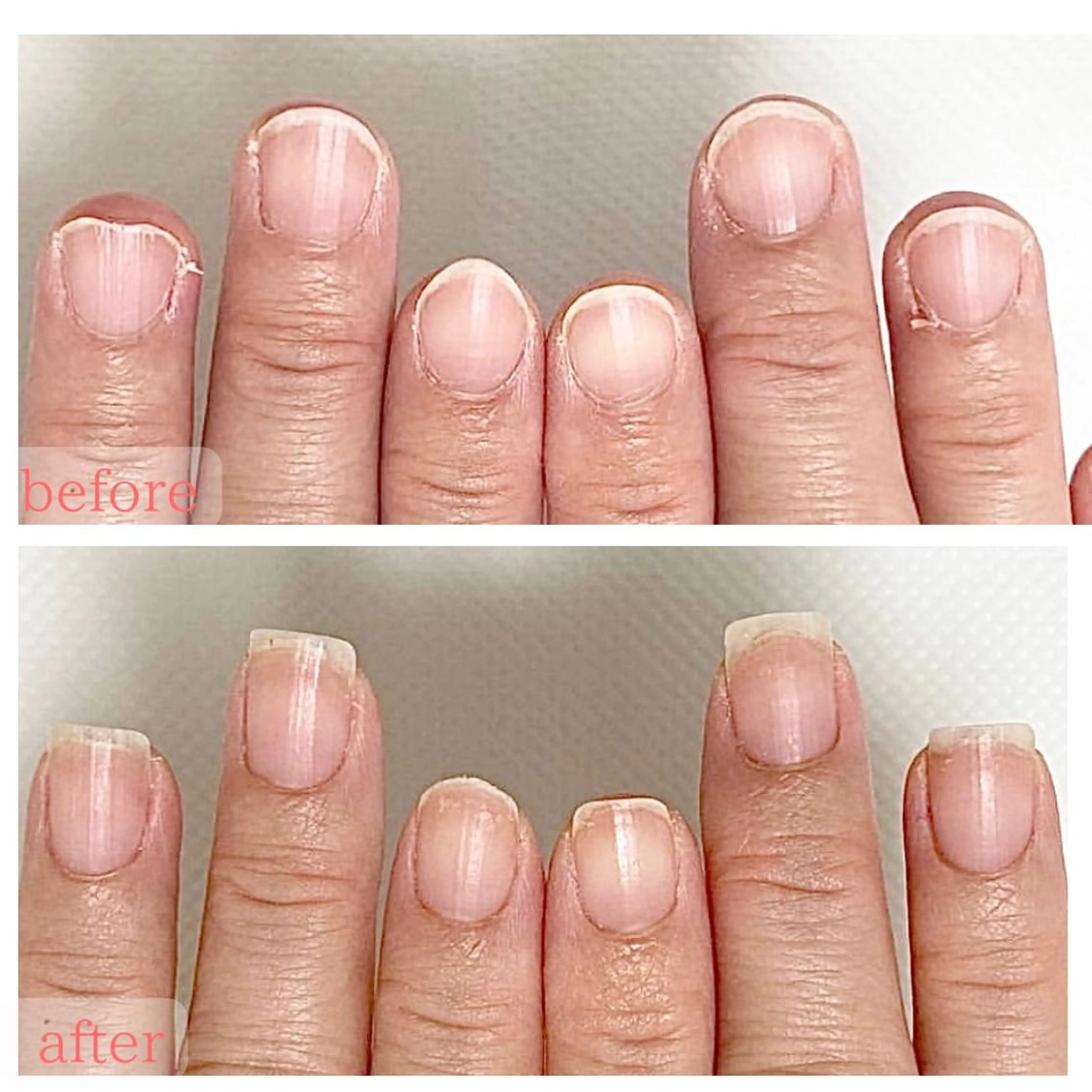 ネイル 深爪・巻き爪 専門サンセリテのネイルデザイン