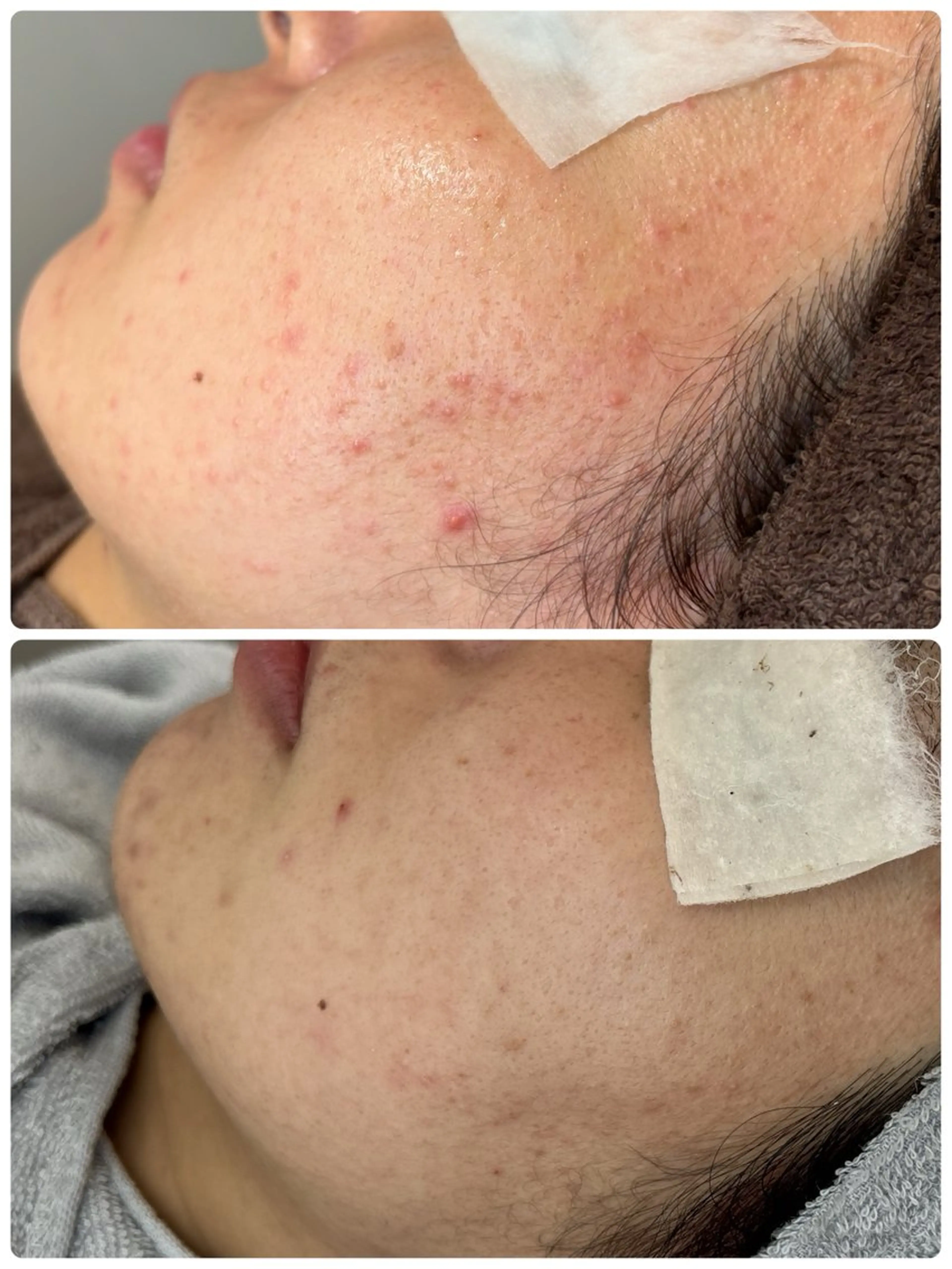 Lien~毛穴 専門サロンのその他イメージ