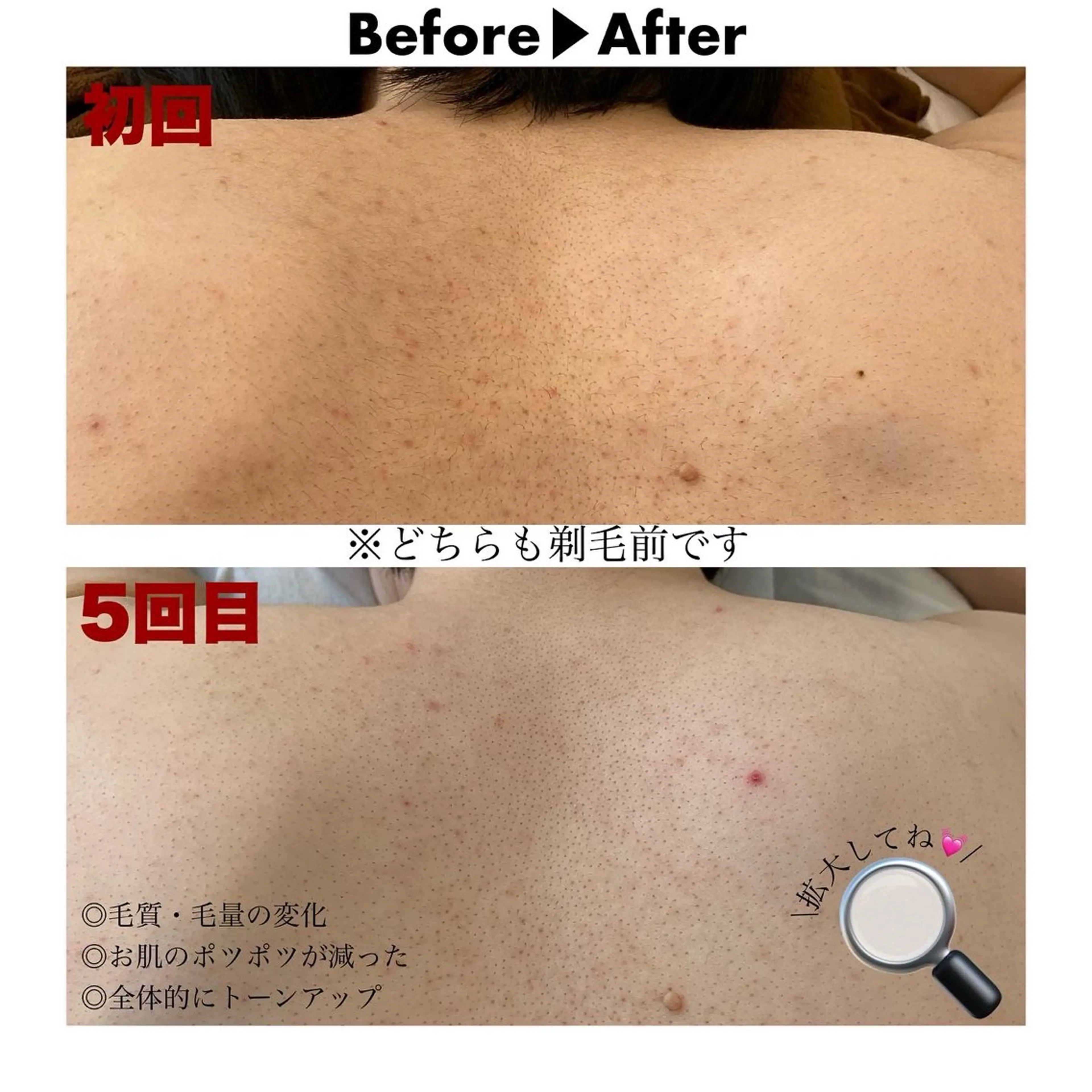 脱毛 美容脱毛専門店 Lé pia レピアのエステ・リラクイメージ