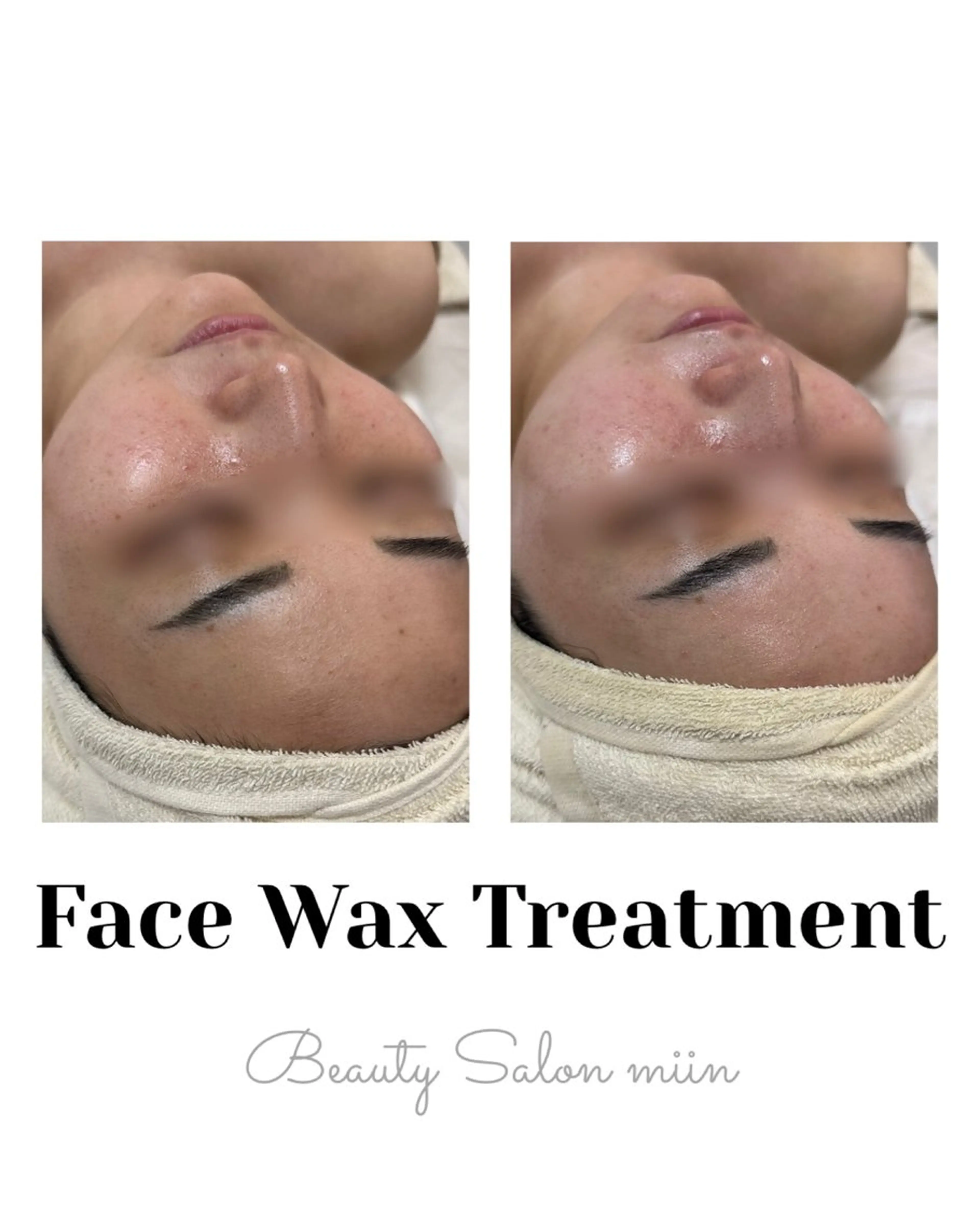 リラク 韓国肌管理 白玉肌管理®︎のエステ・リラクイメージ