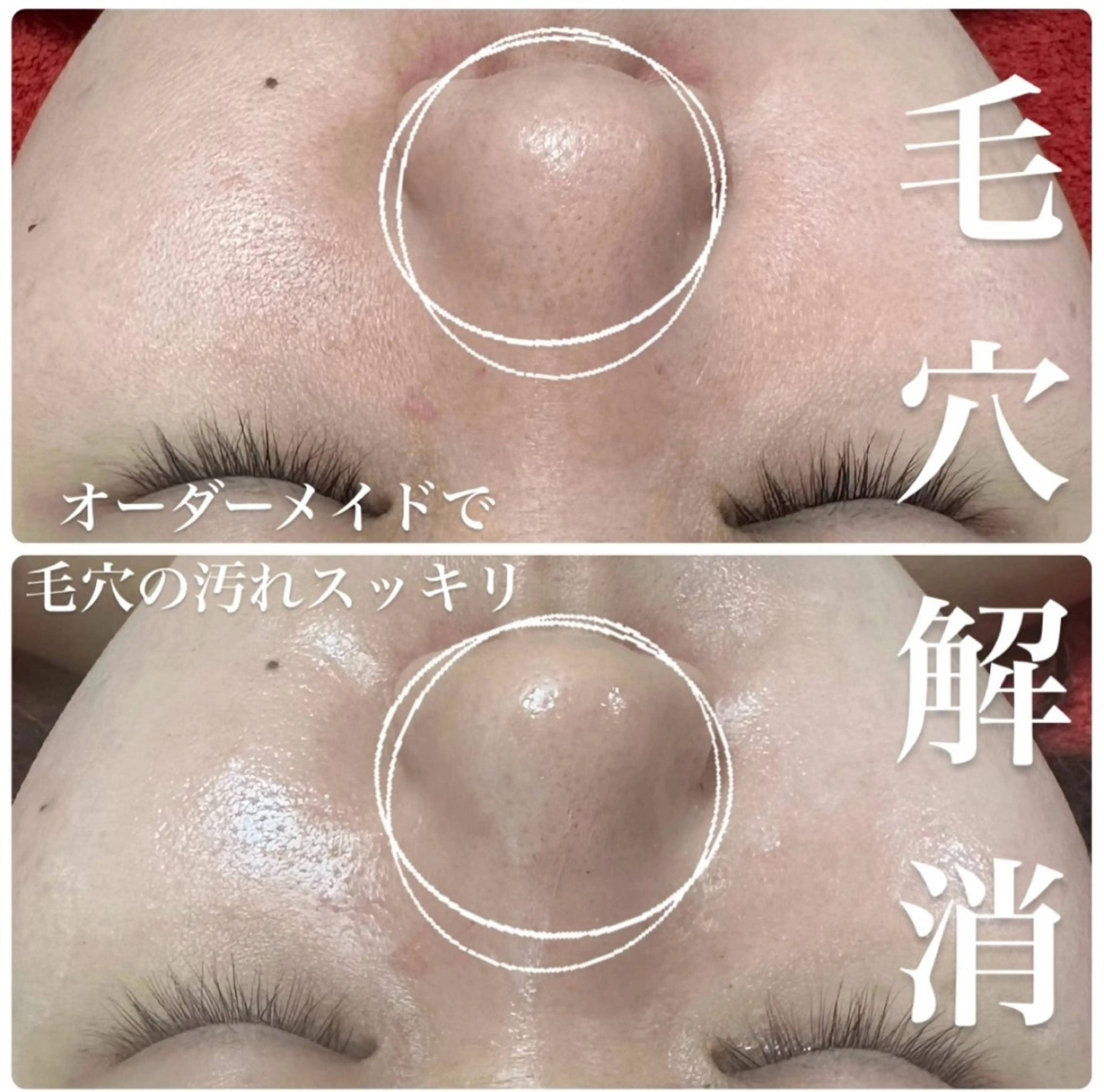 ニキビ毛穴専門店Beautysalon Luana所属・小林 まいのエステ・リラクイメージ