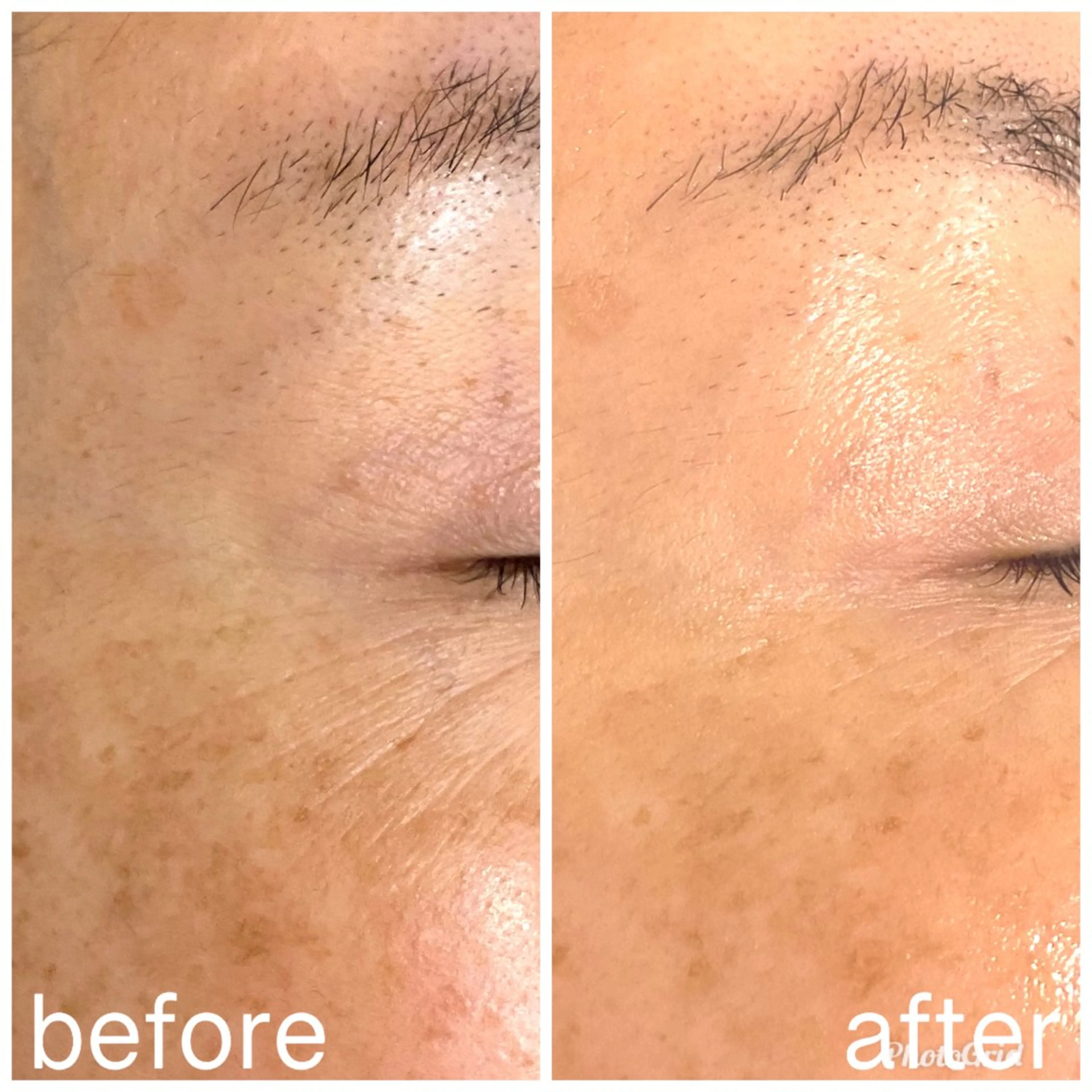 aimer beautyのエステ・リラクイメージ