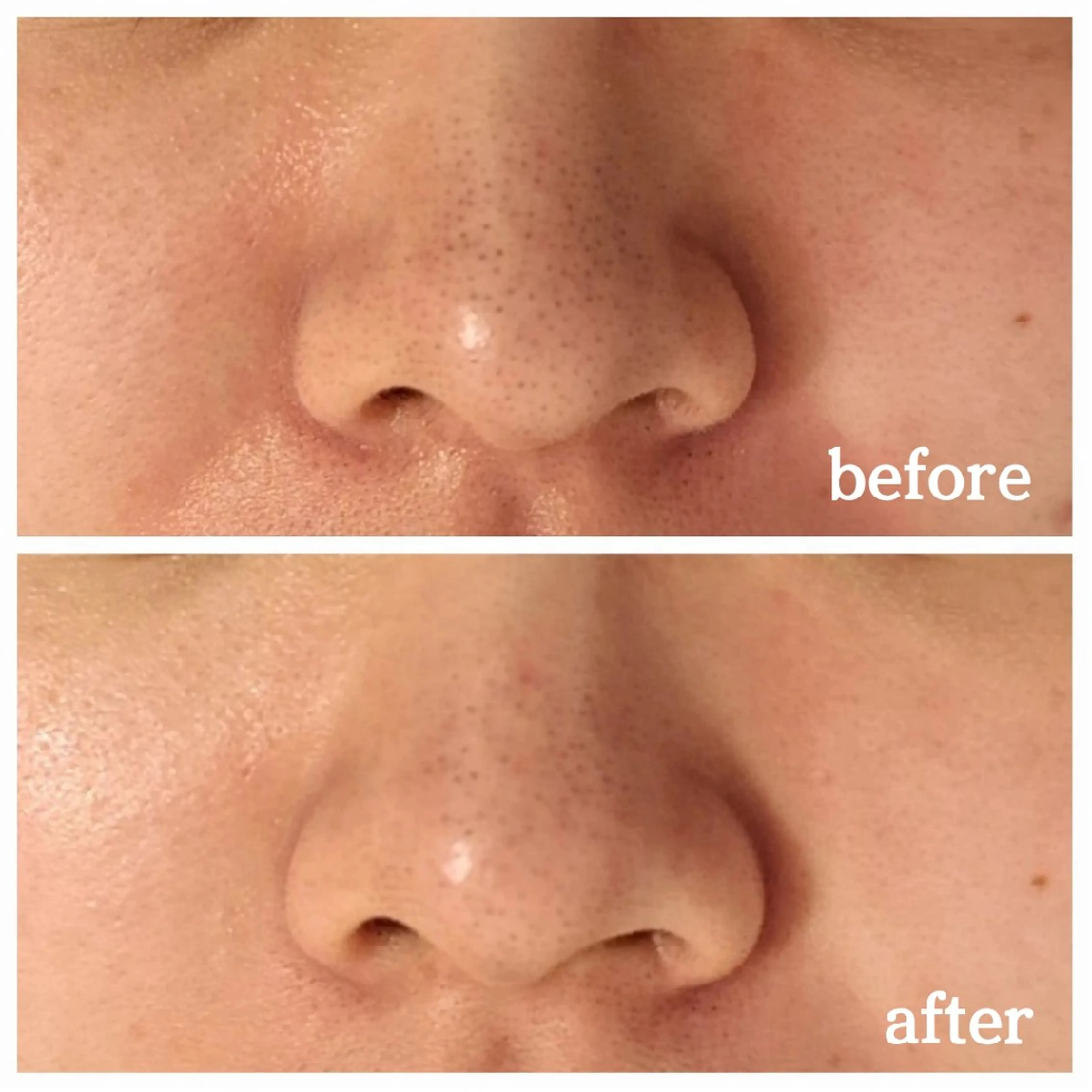 フェイシャル専門サロ ン　ERINのエステ・リラクイメージ