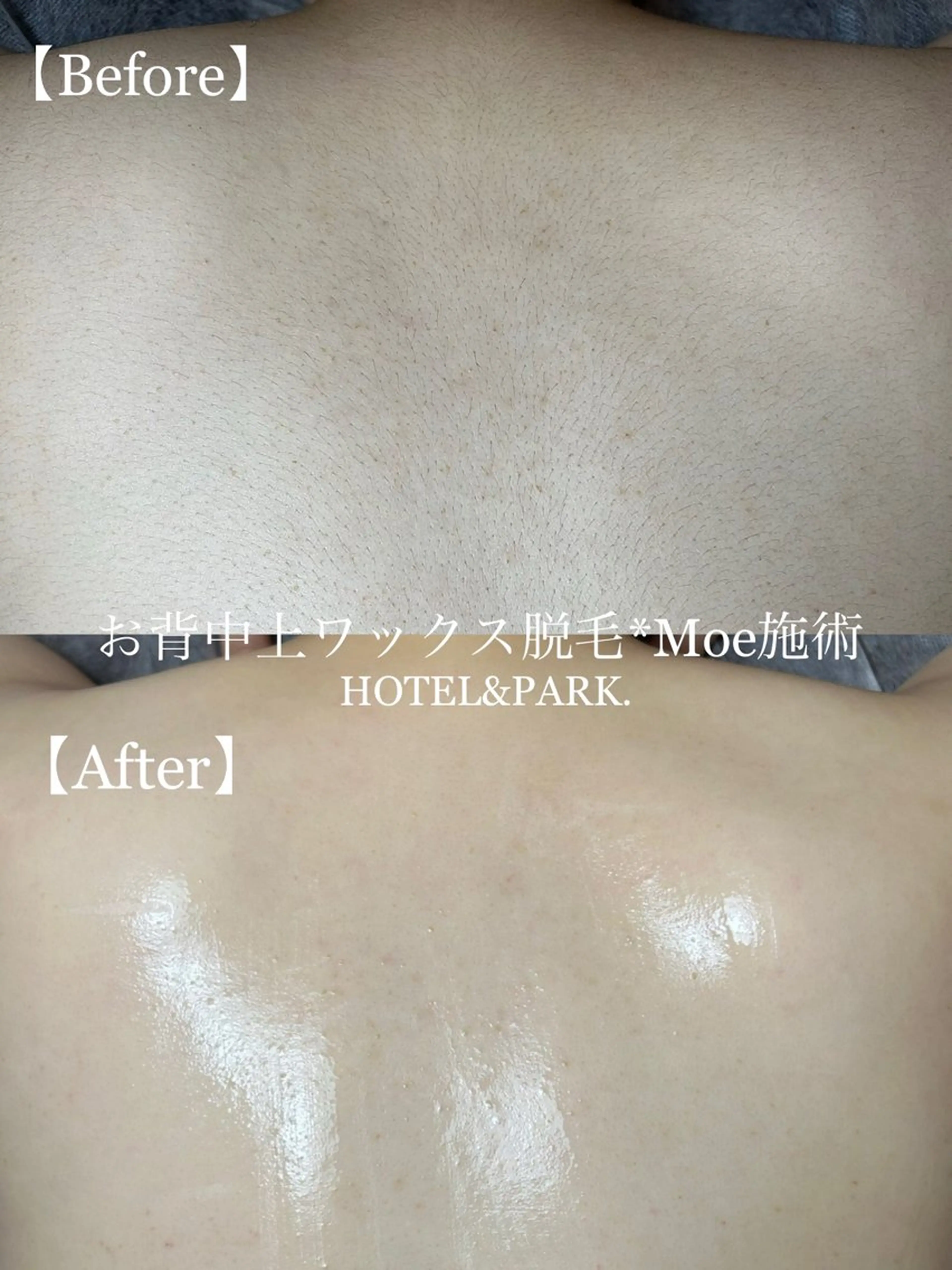 HOTEL&PARK . ワックス脱毛のエステ・リラクイメージ