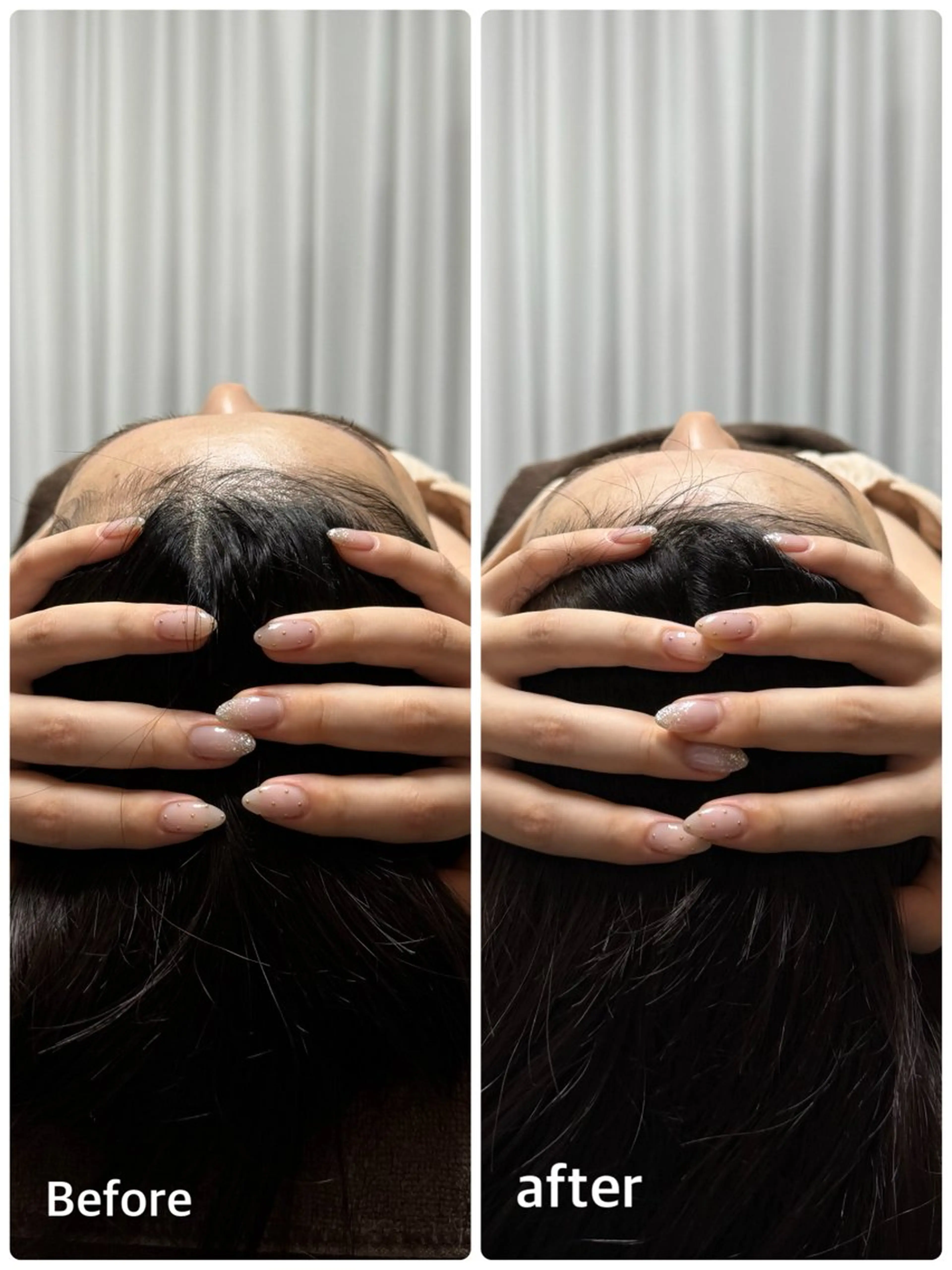 【究極の小顔コース！！】頭蓋骨矯正付き100min✨の写真