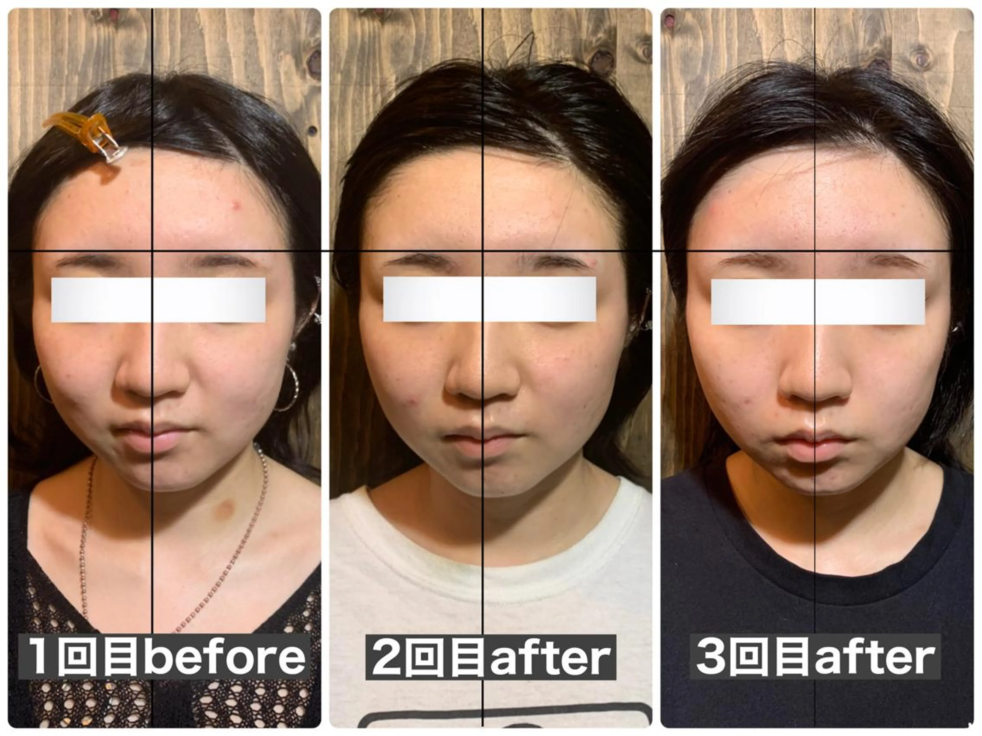 エステ リラク 💎後悔させない小顔 矯正💎イトヤマ🌱のエステ・リラクイメージ