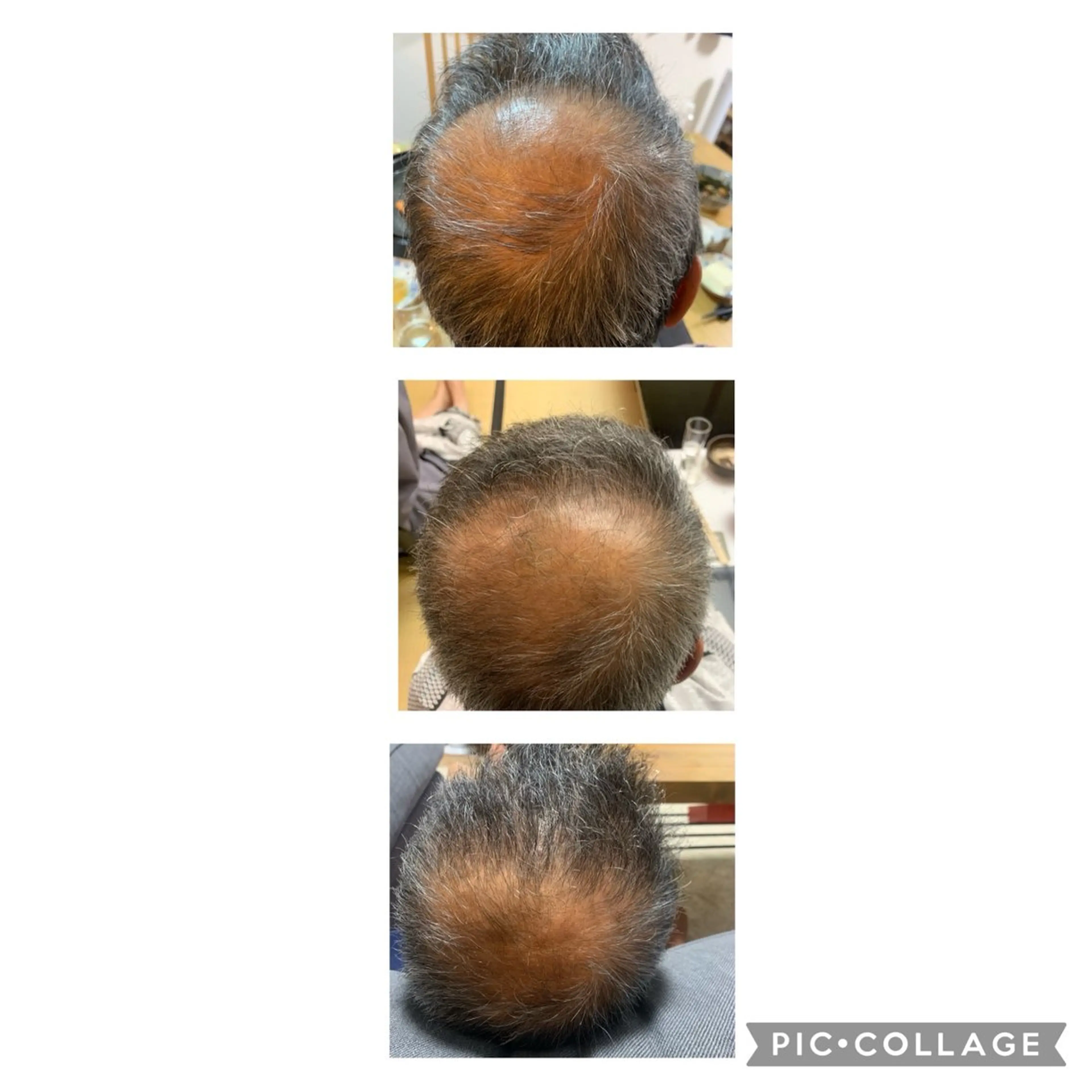 育毛促進 ヘッドスパ40分¥6050→¥3300 育毛促進剤をつけてマッサージの写真