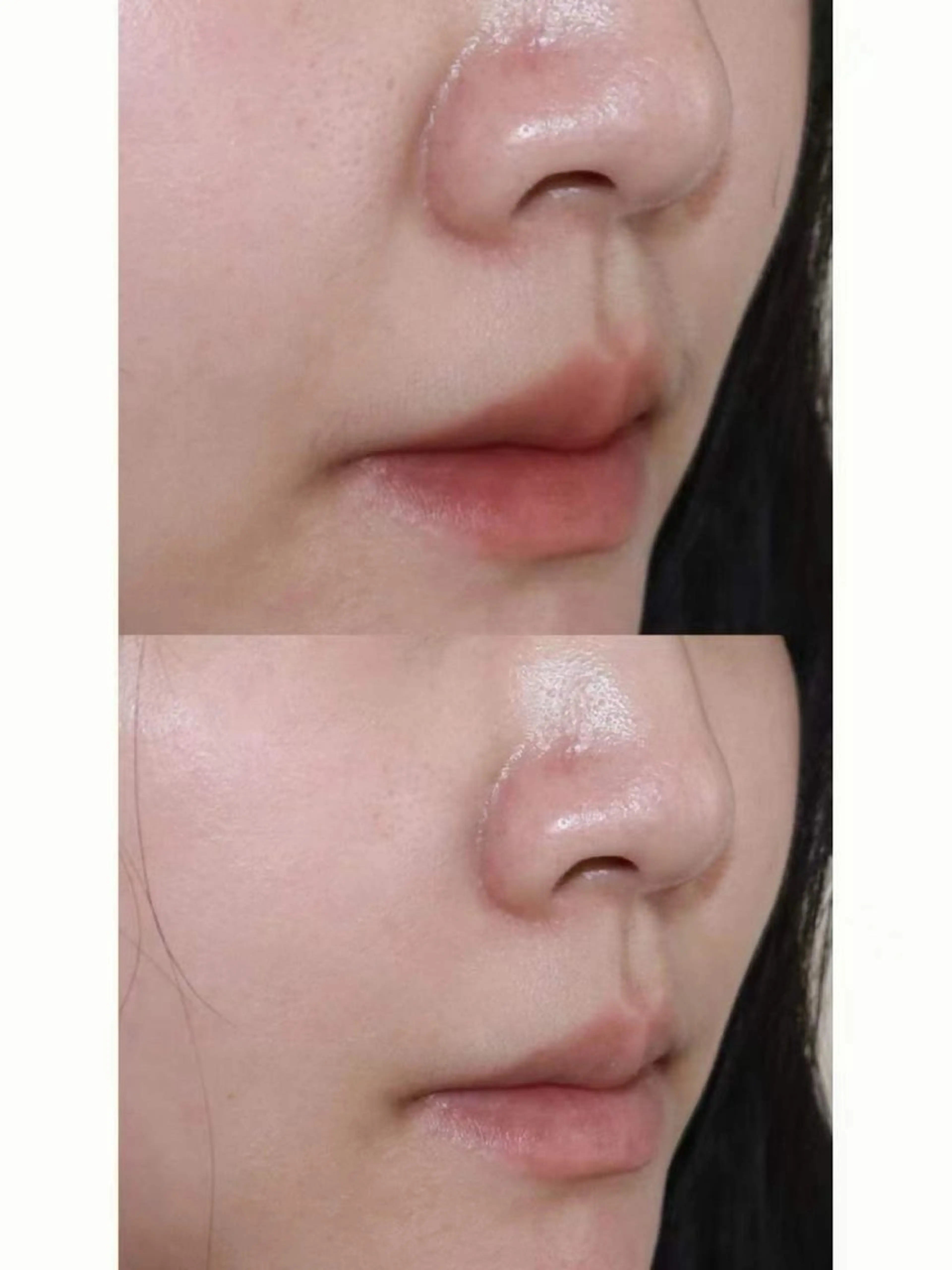 マツエク・マツパ エステ aliaハイフ&水光ジェットサロン所属・aliaハーブ水光店 エステティシャン募集のエステ・リラクイメージ