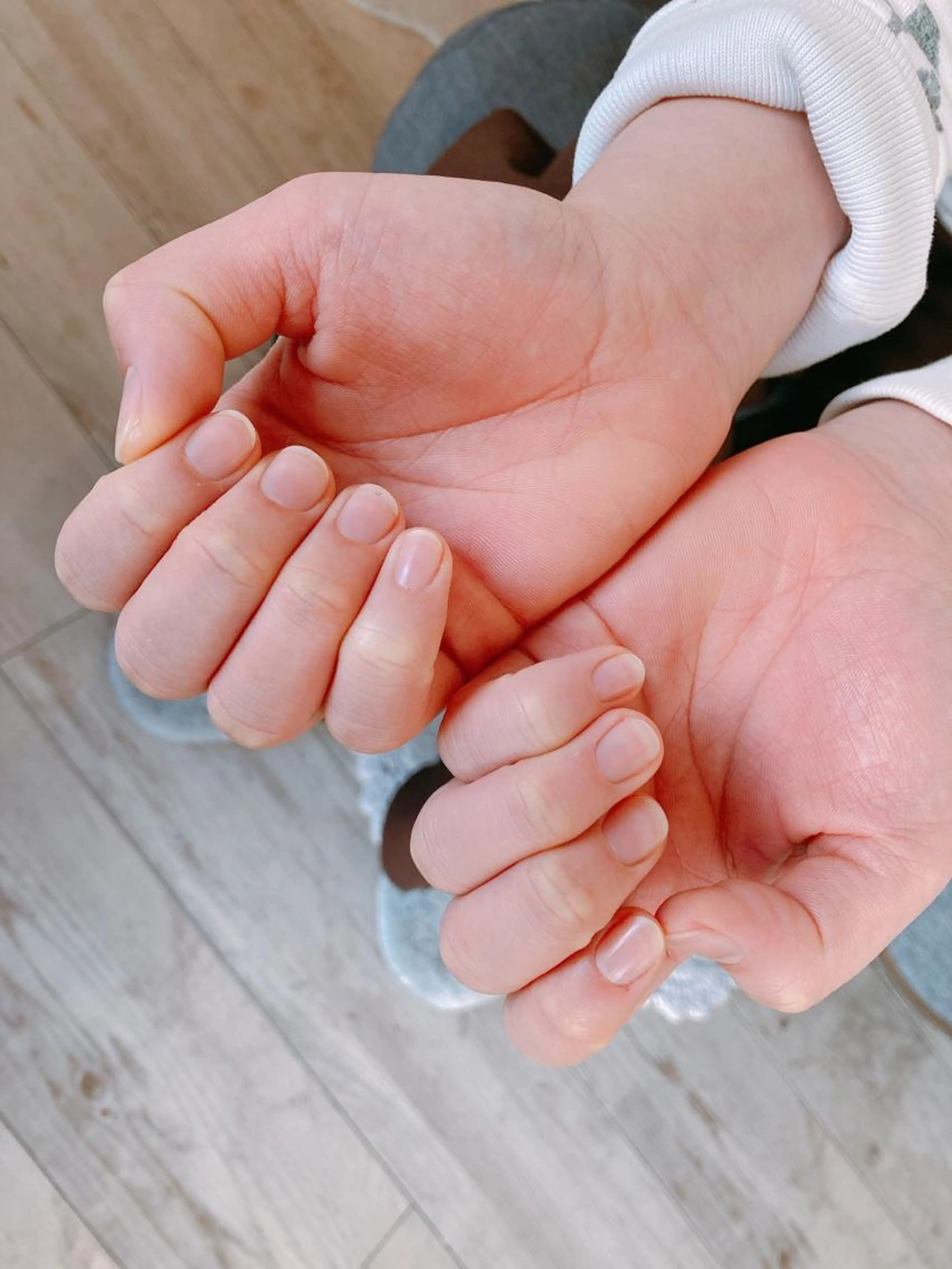 自爪ケア6回分のお得チケット🎫通常¥39,600の写真