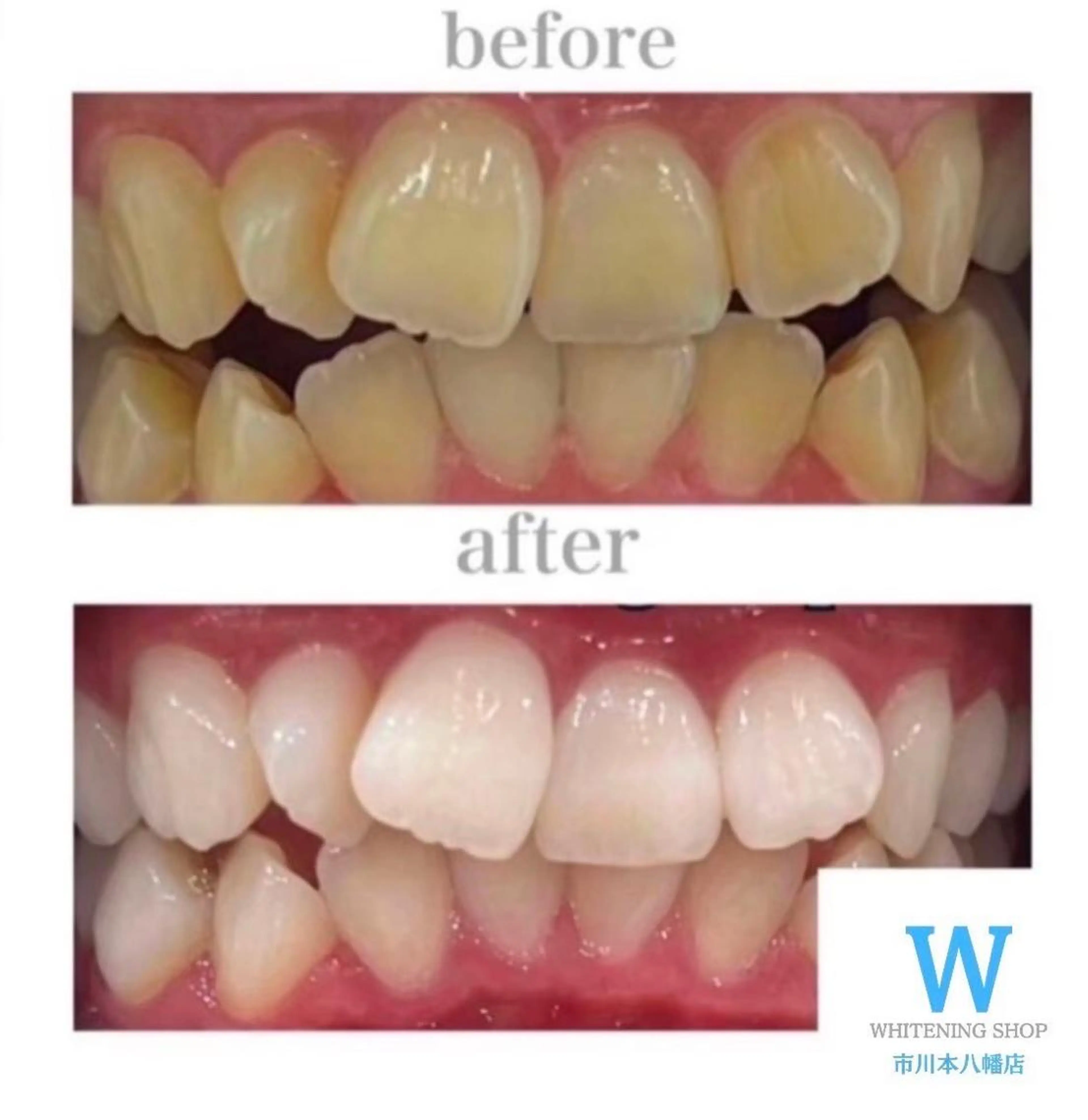 ホワイトニング ショップ本八幡店のエステ・リラクイメージ