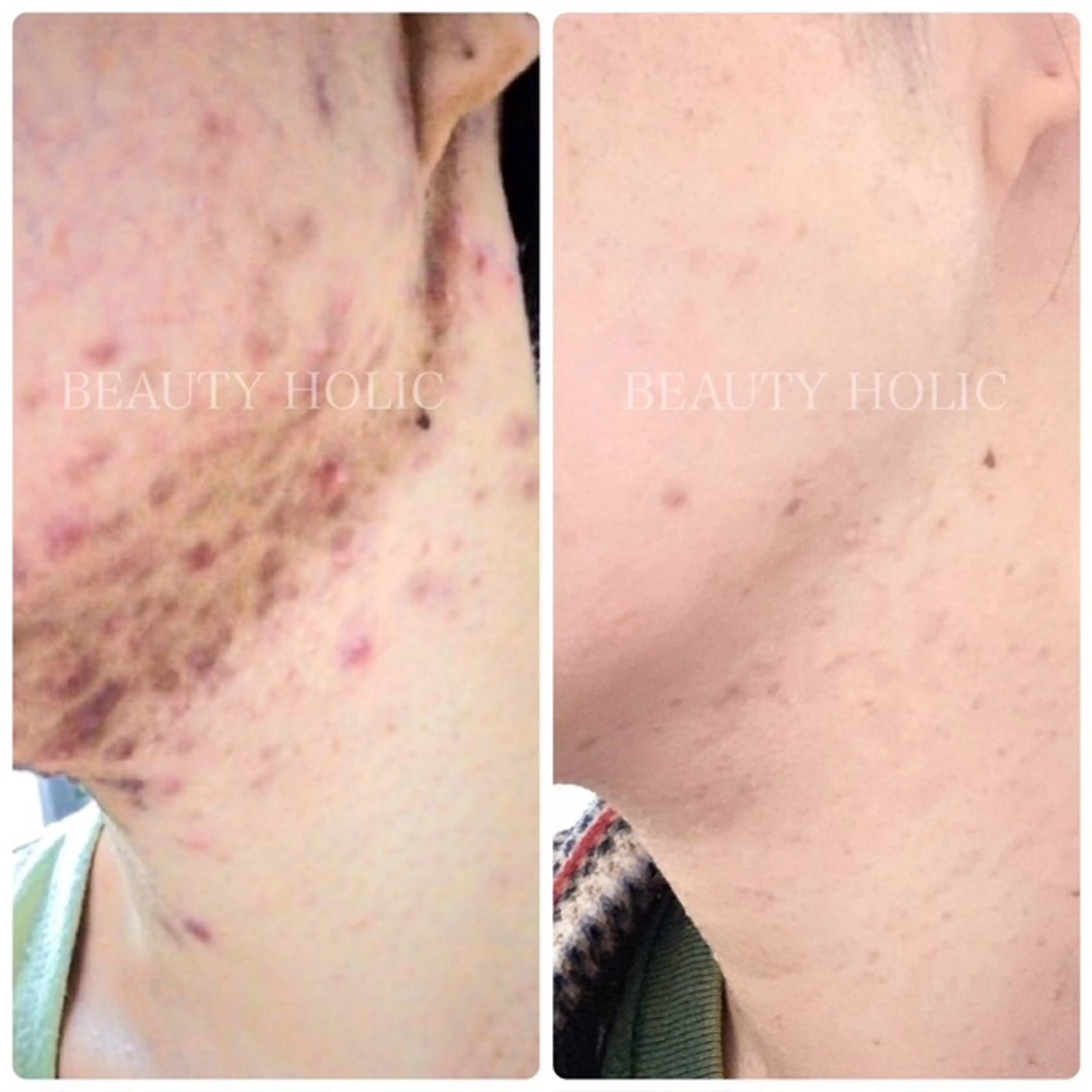 ビューティーホリック 東金店のエステ・リラクイメージ