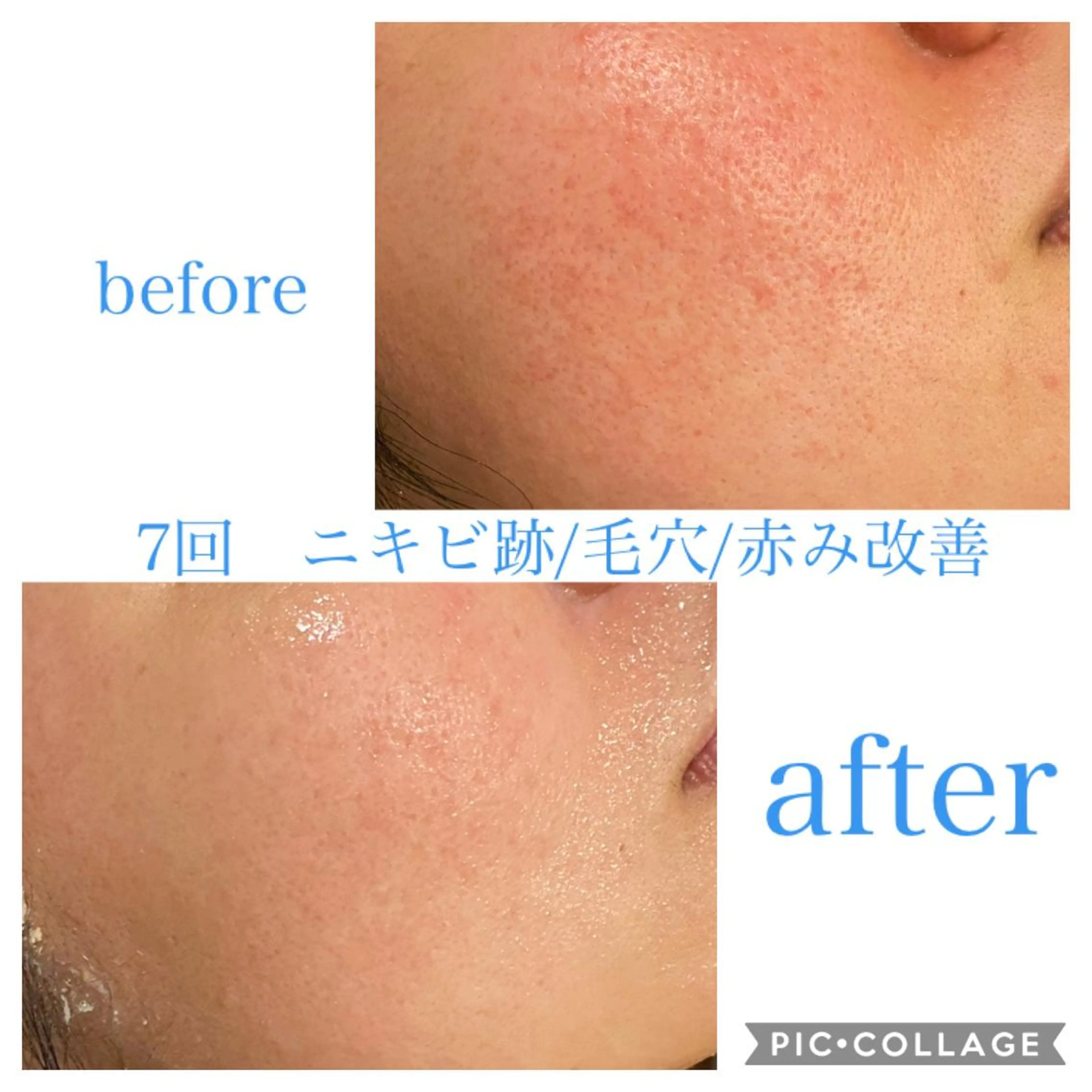 セミロング カラー パーマ ヘアアレンジ メンズ ネイル マツエク・マツパ エステ リラク EnsorClair 代表　野口真央のエステ・リラクイメージ